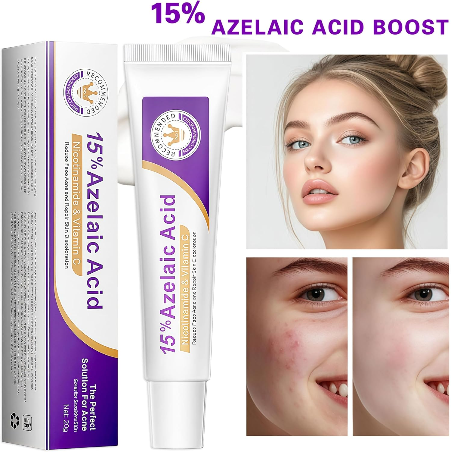Ai-Uchoice Azelaic Acid 10% Cream for Face Body, 0.7 OZ Azelaic Acid Acne Cream Gel with Salicylic Acid for Skin Balancing Nourishing for Sensitive Skin Care & Daily Routines (Ai-Uchoice, 15% Azelaic Acid Cream) image number 4
