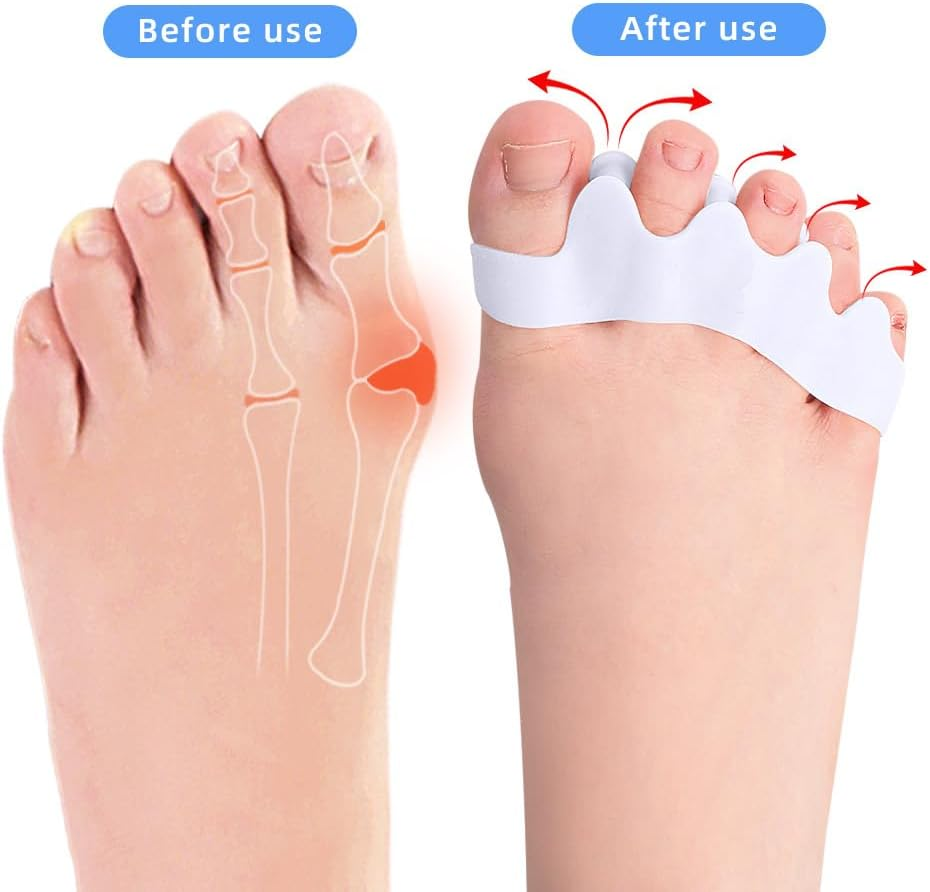Toe Spacers for Bunions & Hammer Toe - 5 Hole Breathable Toe Separators, Gel High Elastic Hallux Valgus Corrector, Comfortable Toe Straightener for Foot Pain Relief [2 Pairs] image number 4