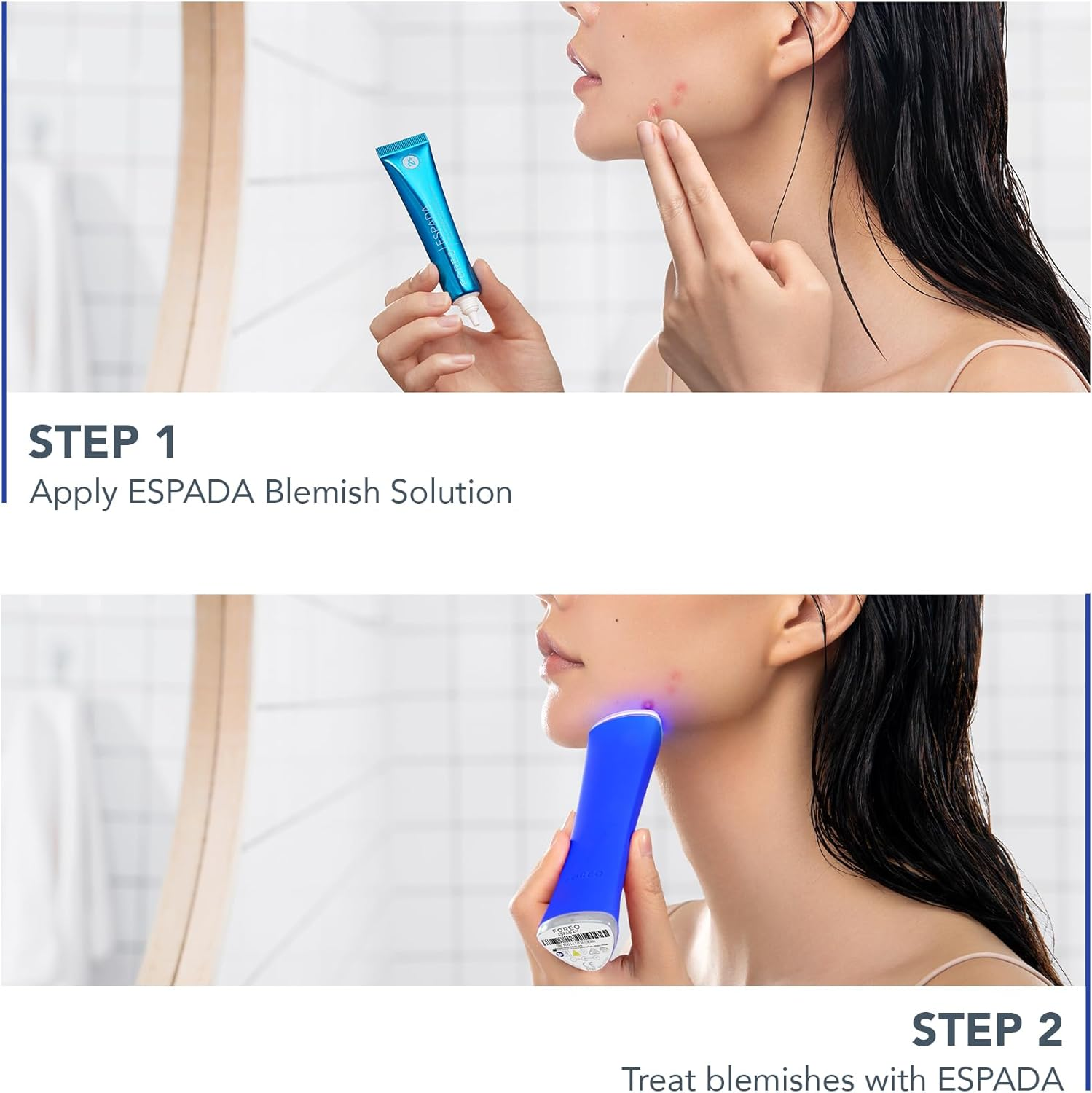 FOREO ESPADA 2 Anti-Blemish Light Skincare Device - Blemish Trace Fading - Pimple, Spot & Blemish Removal - Clear Skin - Cobalt Blue image number 1