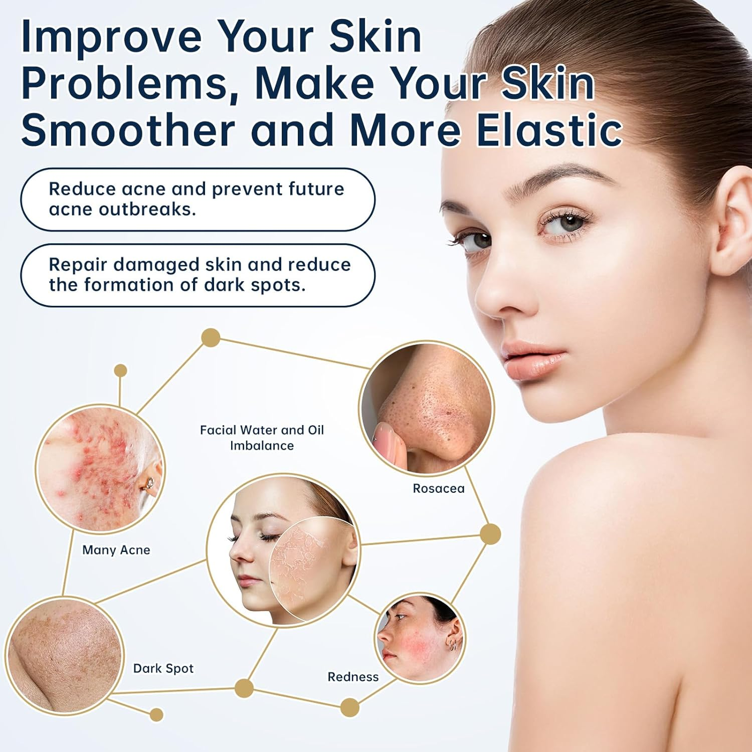 Azelaic Acid 14 Percent Cream for Face, Azelaic Acid Gel, 30ML Azelaic Acid Acne Cream with Salicylic Acid, Niacinamide & Vitamin C for Dark Spot. image number 5