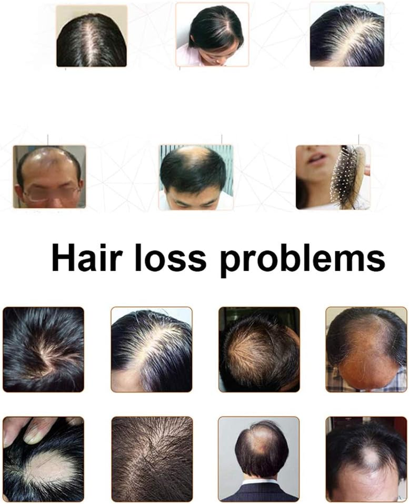 Chusui Hair Growth Essence 30Ml Effective Scalp Nutritious Repair Hair Growth Enhance Tool Hair Care Healthy Hair Growth Essence Oil image number 5