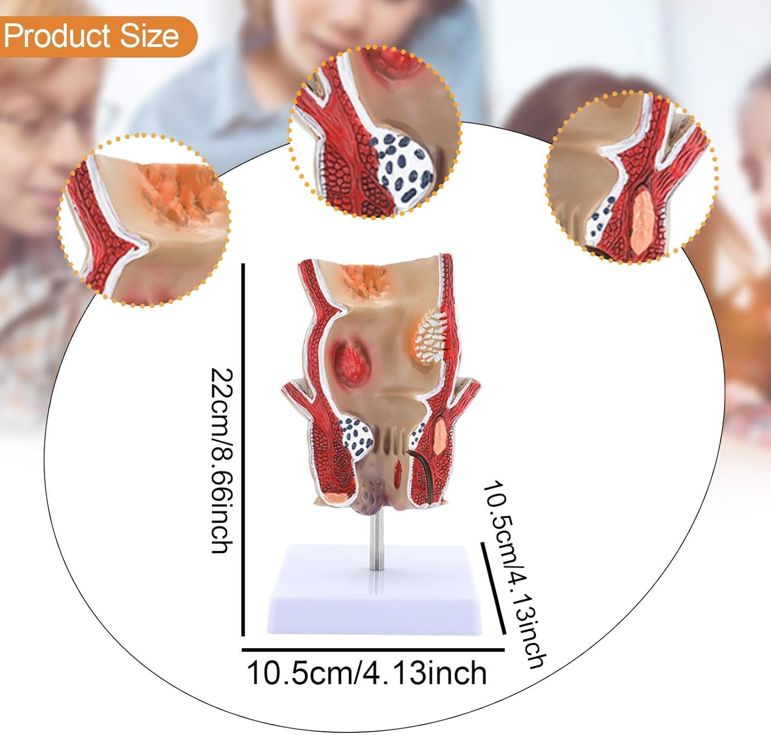 Eigell Human Pathology Rectal Model Educational Display Tool for Study School image number 3