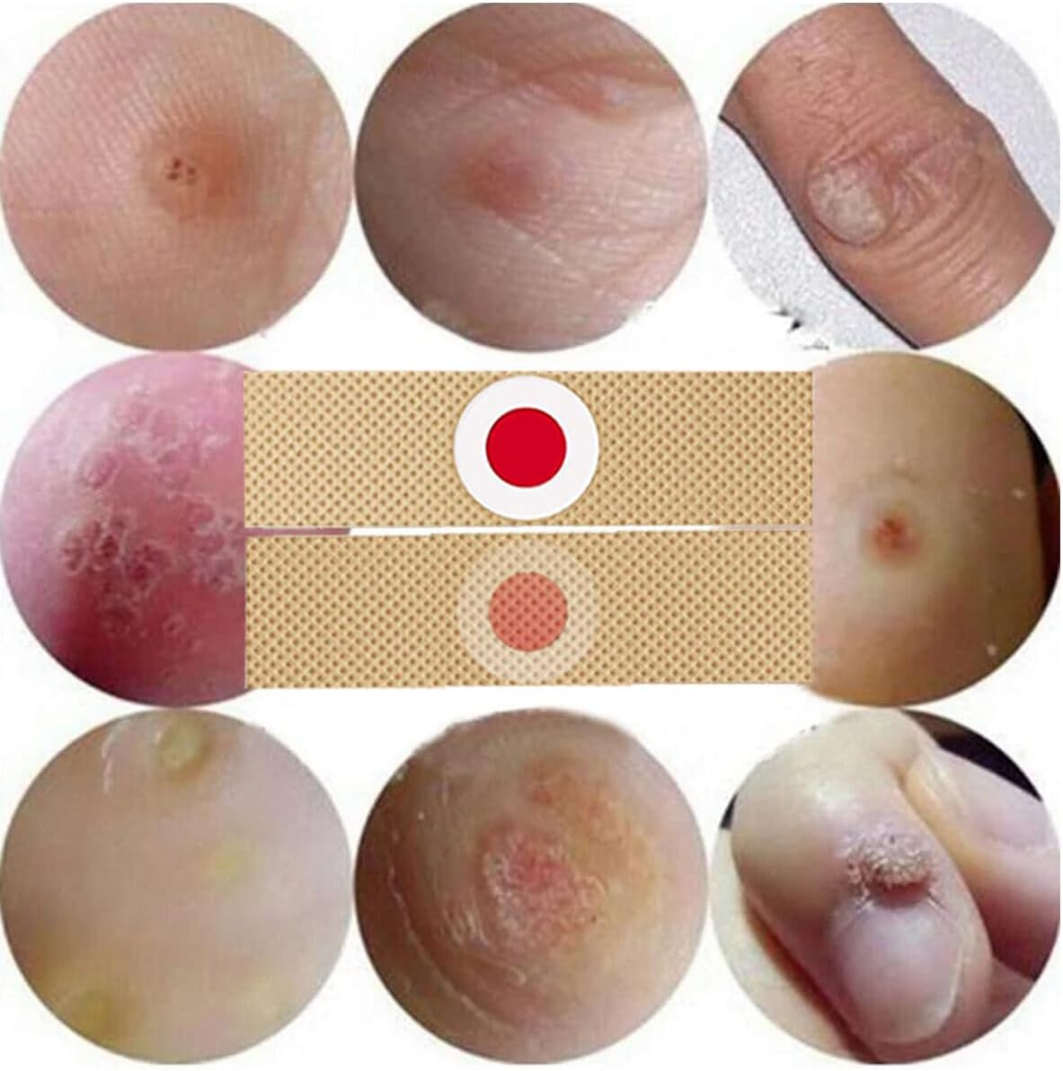 MYMULIKE 48Pcs Corn Removers for Toes & Feet, Tackle Tough Corns with Ease, 0.4" Diameter Large Size, Experience Quick Recover with Powerful, Easy-To-Use Corn Removal image number 1