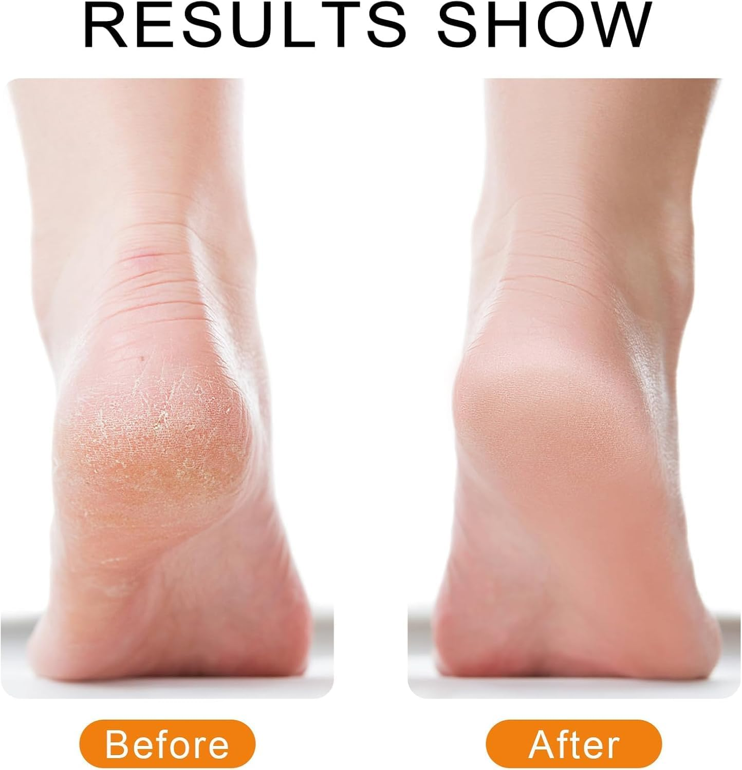 Ronluuu Electric Callus Remover for Feet, Rechargeable Portable Electronic Foot File Pedicure Kits, Professional Waterproof Pedi Feet Care Tools Wet&Dry Foot Scrubber File Perfect for Hard Cracked Dry Dead Skin (6) image number 2