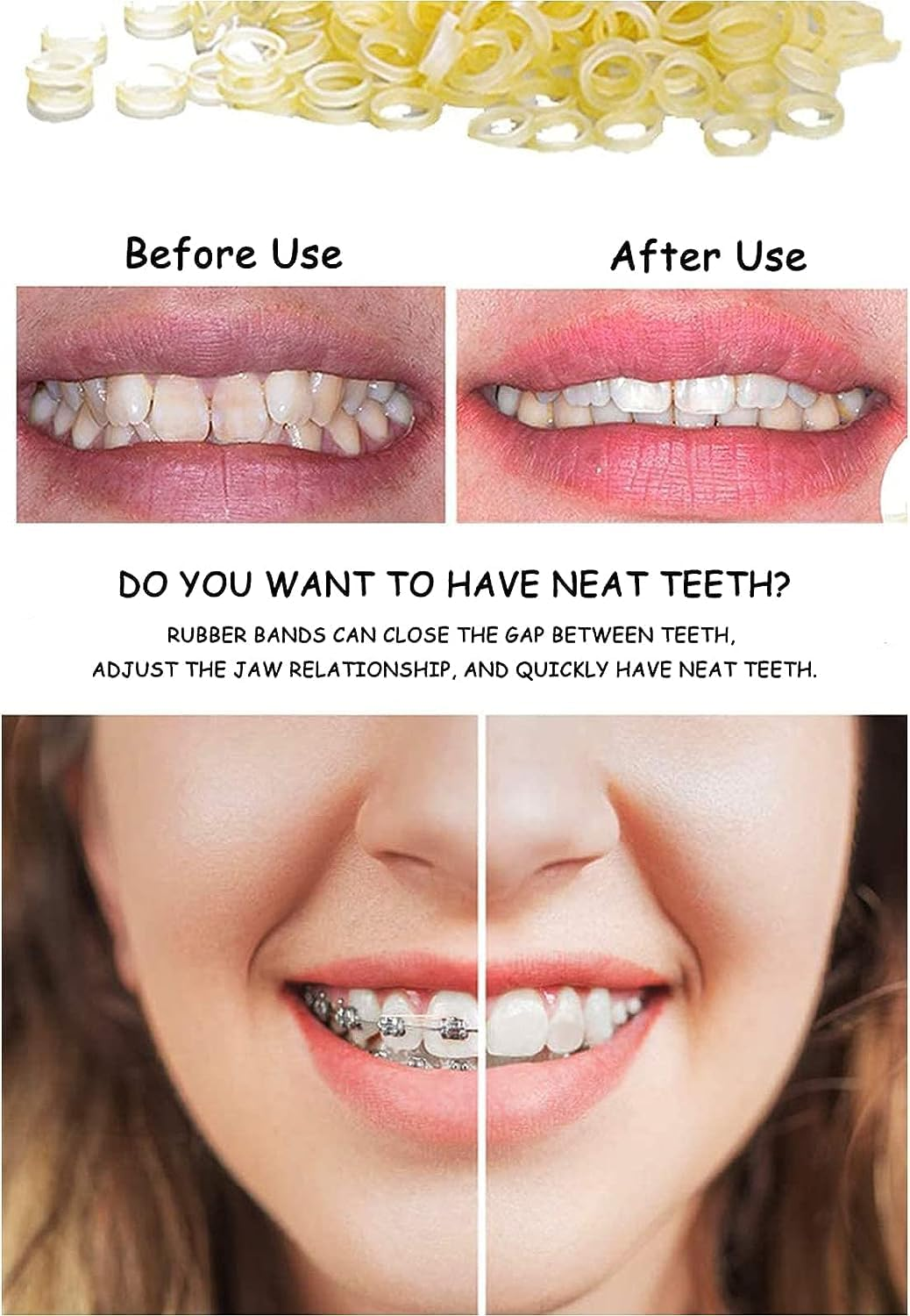 500 Pcs Orthodontic Elastic Bands Dental Orthodontic Elastics Latex Rubber Bands (Penguin5/16") image number 1