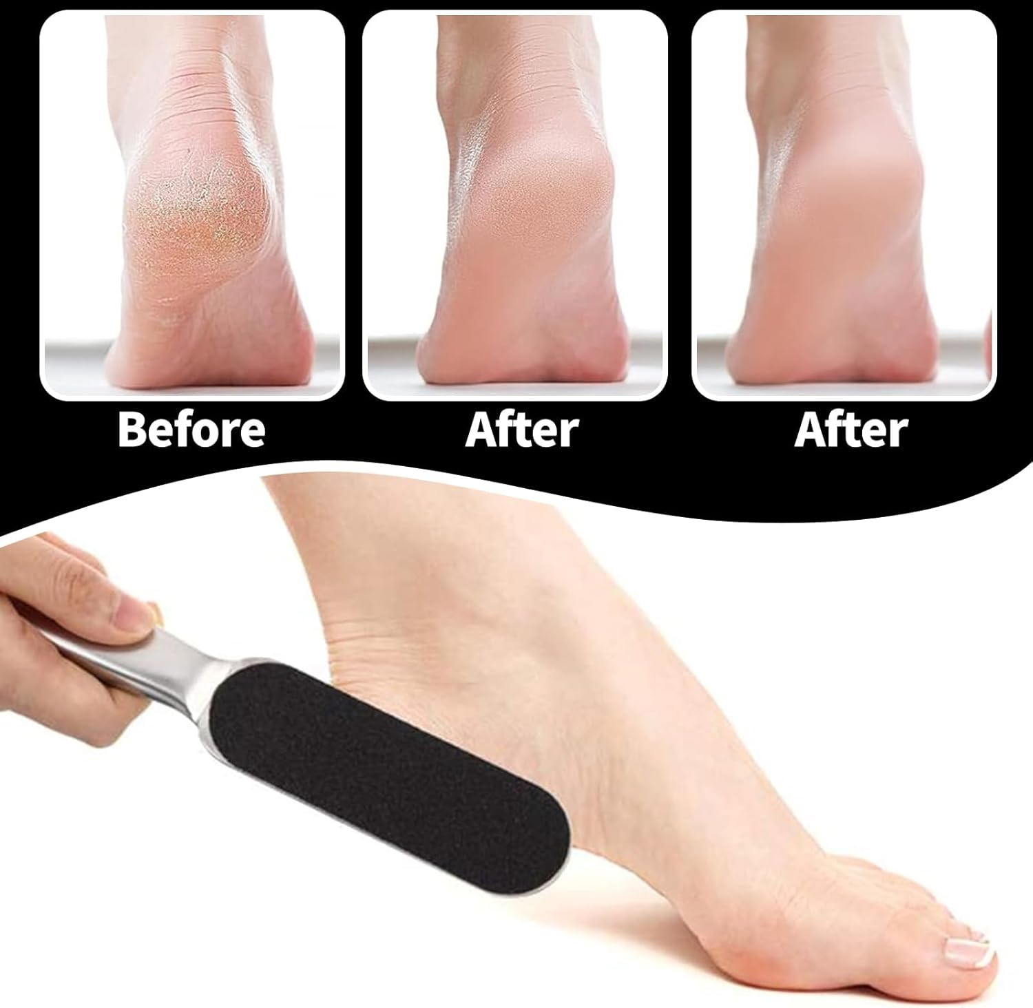 Wjelet Callus Removal Foot Set, Foot File with 20 Replacement Sandpapers, Double-Sided Callus File for Wet and Dry Feet, Stainless Steel Callus Remover for Smooth and Nourished Foot Skin image number 1