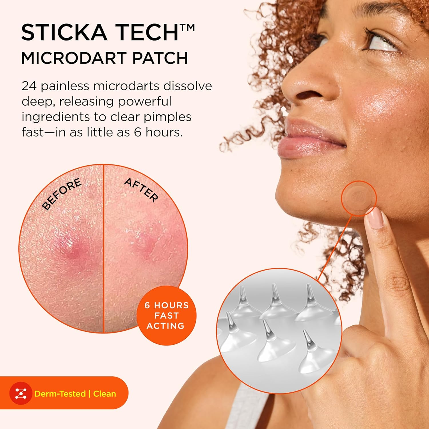 Zitsticka Killa Pimple Patches for Face - World'S Most Potent Pimple Patch with Fast-Acting Microdarts - Starts Working within 6 Hours for Deep, Early-Stage Zits - Regular 8 Count with Cleana Swab image number 2