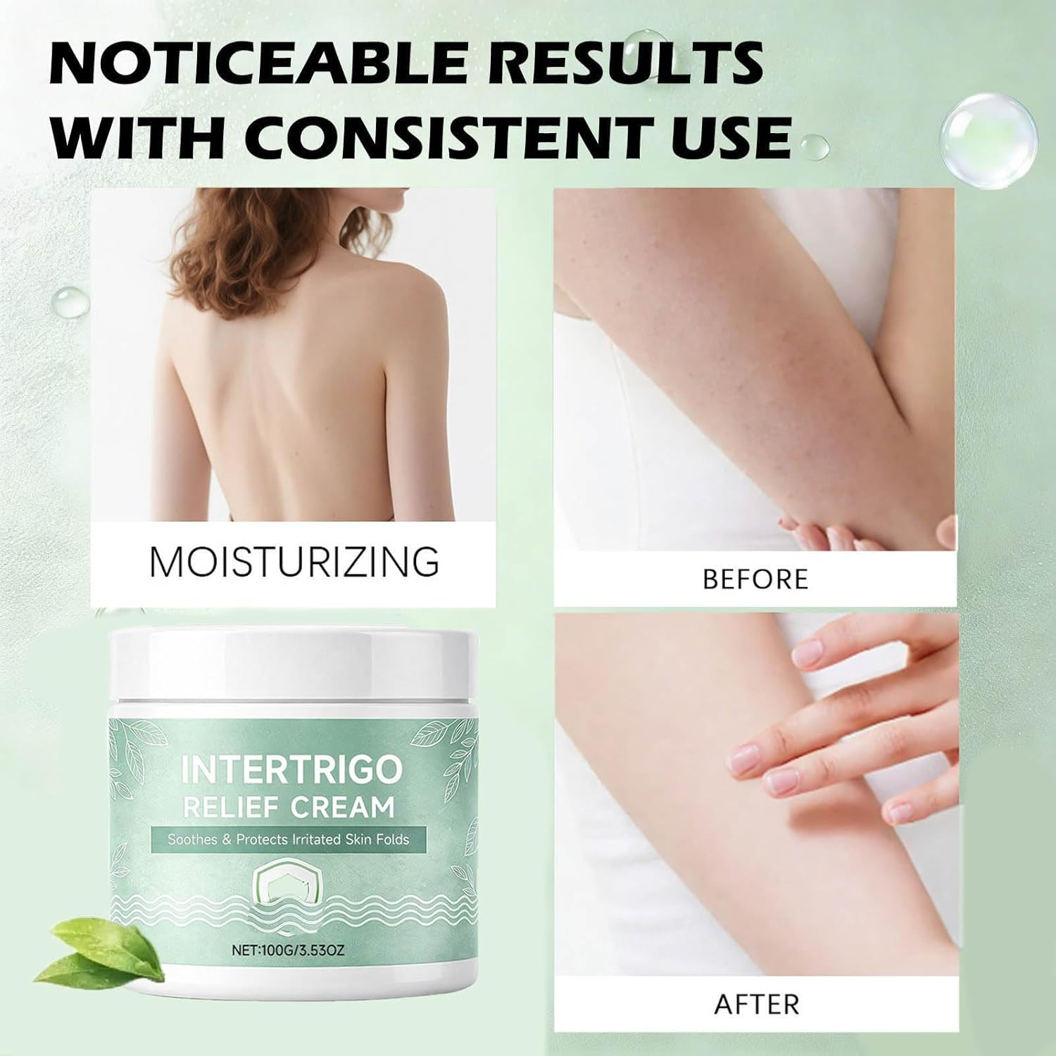 Skin Fold Barrier Cream for Moisture & Friction Protection, Fast-Drying Non-Greasy Formulation Supports Comfort in Friction-Prone Areas, Suitable for All Seasons (1 Pcs) - 3 Pcs image number 6