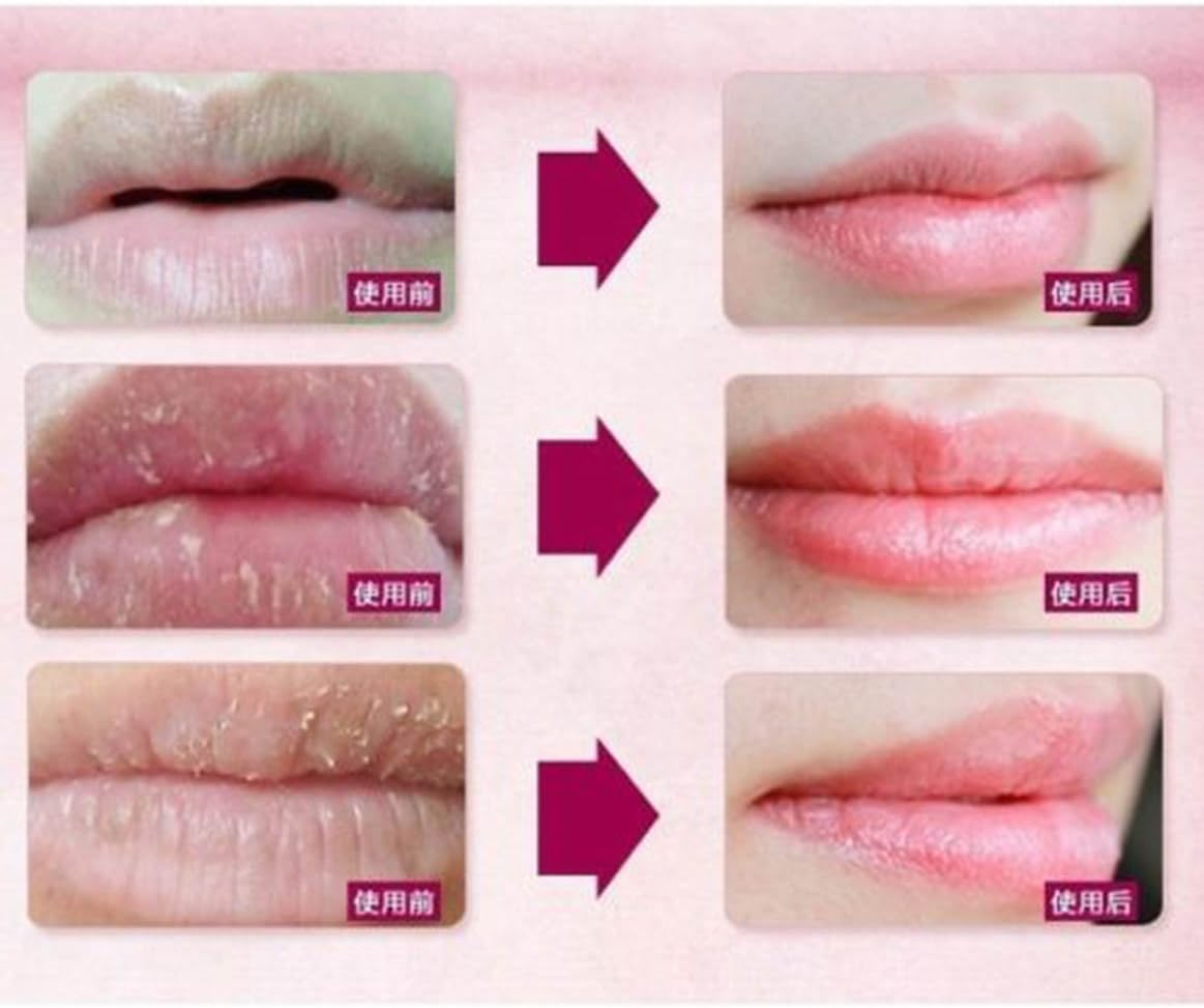 5 Masks 24K Gold Collagen Lip Treatment Mask Patches. Plumper Fuller Softer Lips. anti Aging Reduce Fine Line Wrinkles Creases Hydrating Moisturizing Uplifting Tone Firmer Smooth Lips Regeneration. image number 2