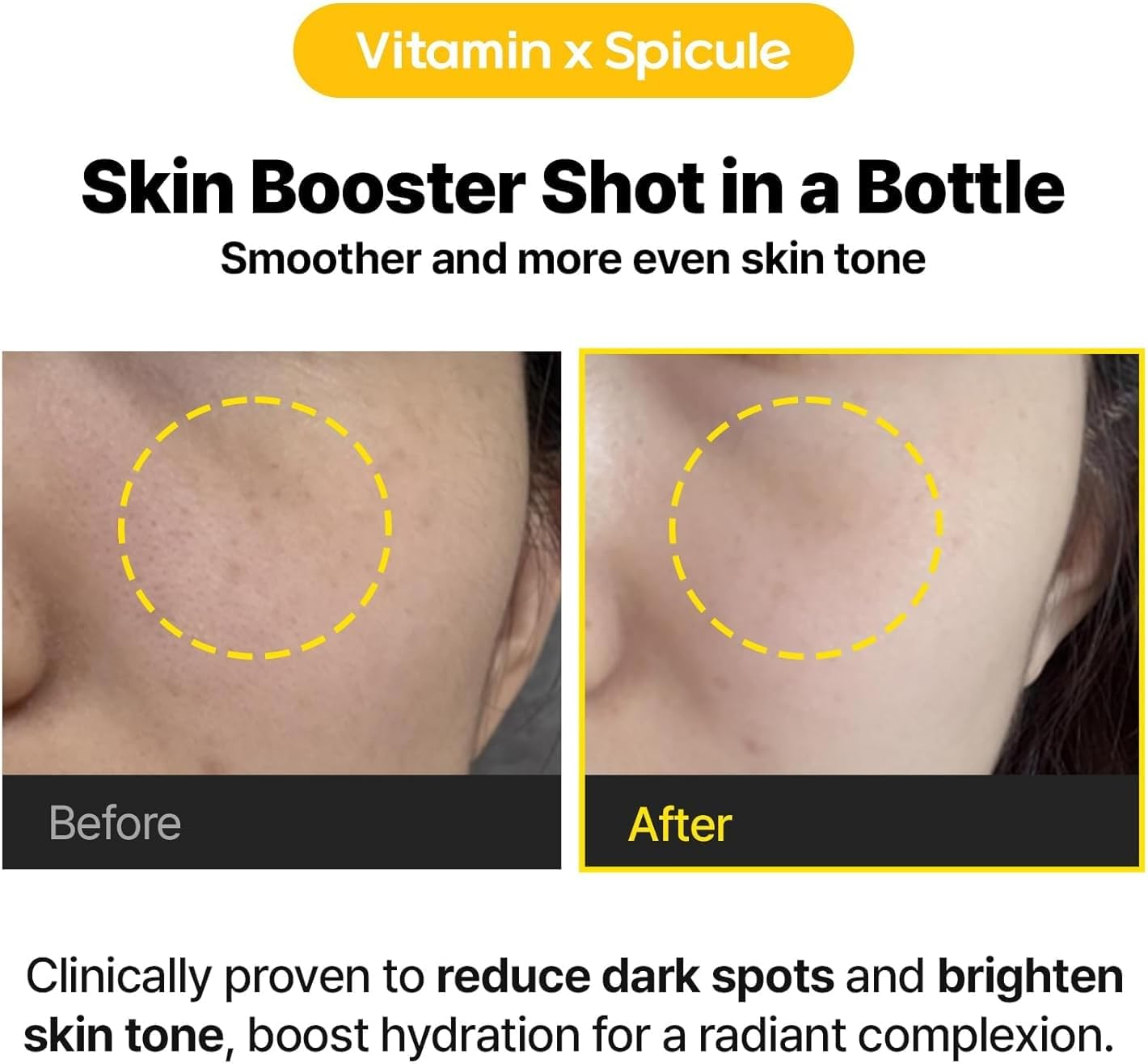 Cell Fusion C Toning C Vita Shot Ampoule, 15% Vitamin C + Spicule 300 Shot, Skin Booster Serum for Face, Exfoliation & Dark Spots, 20G / 0.7 Oz. image number 1