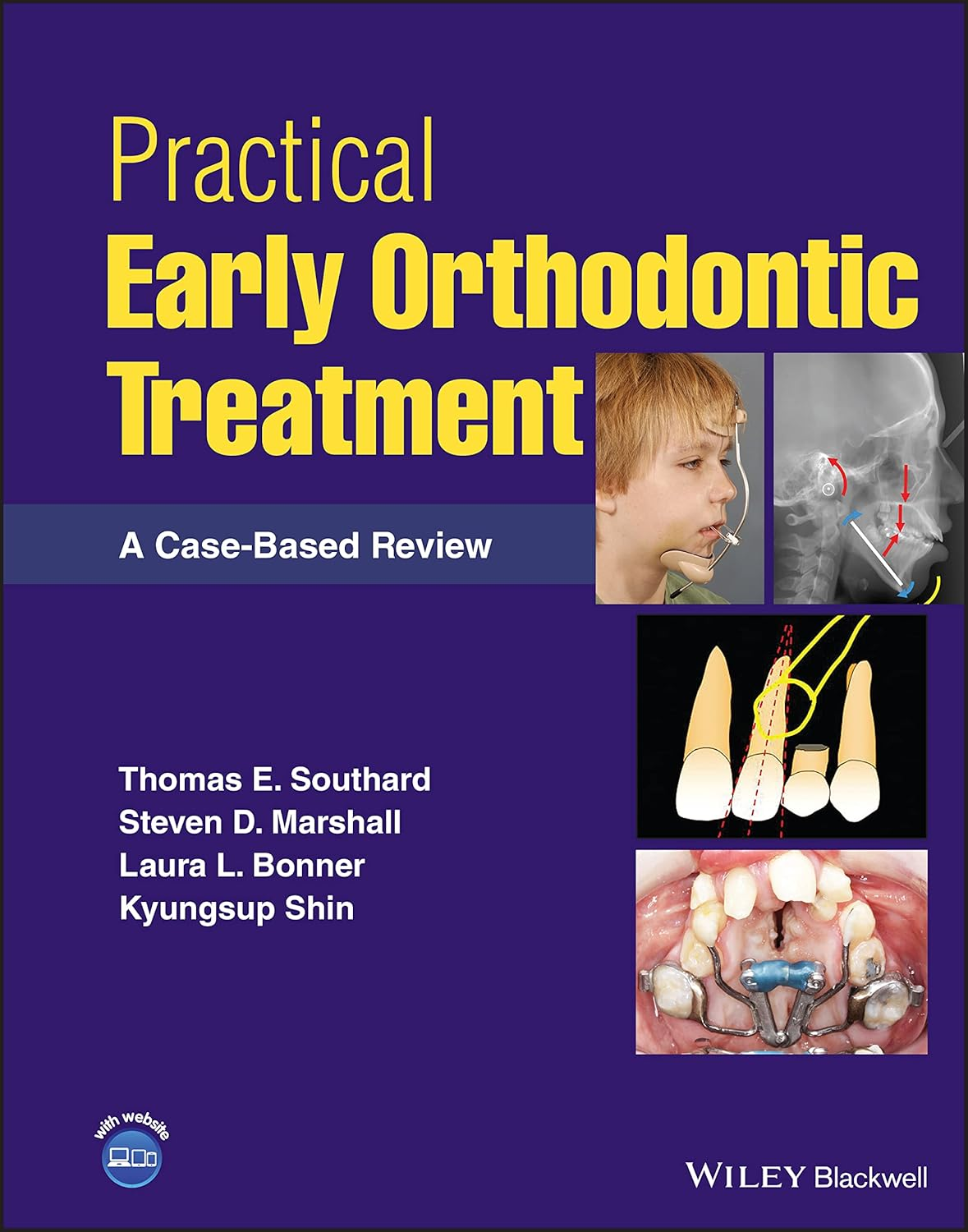 Practical Early Orthodontic Treatment: a Case-Based Review