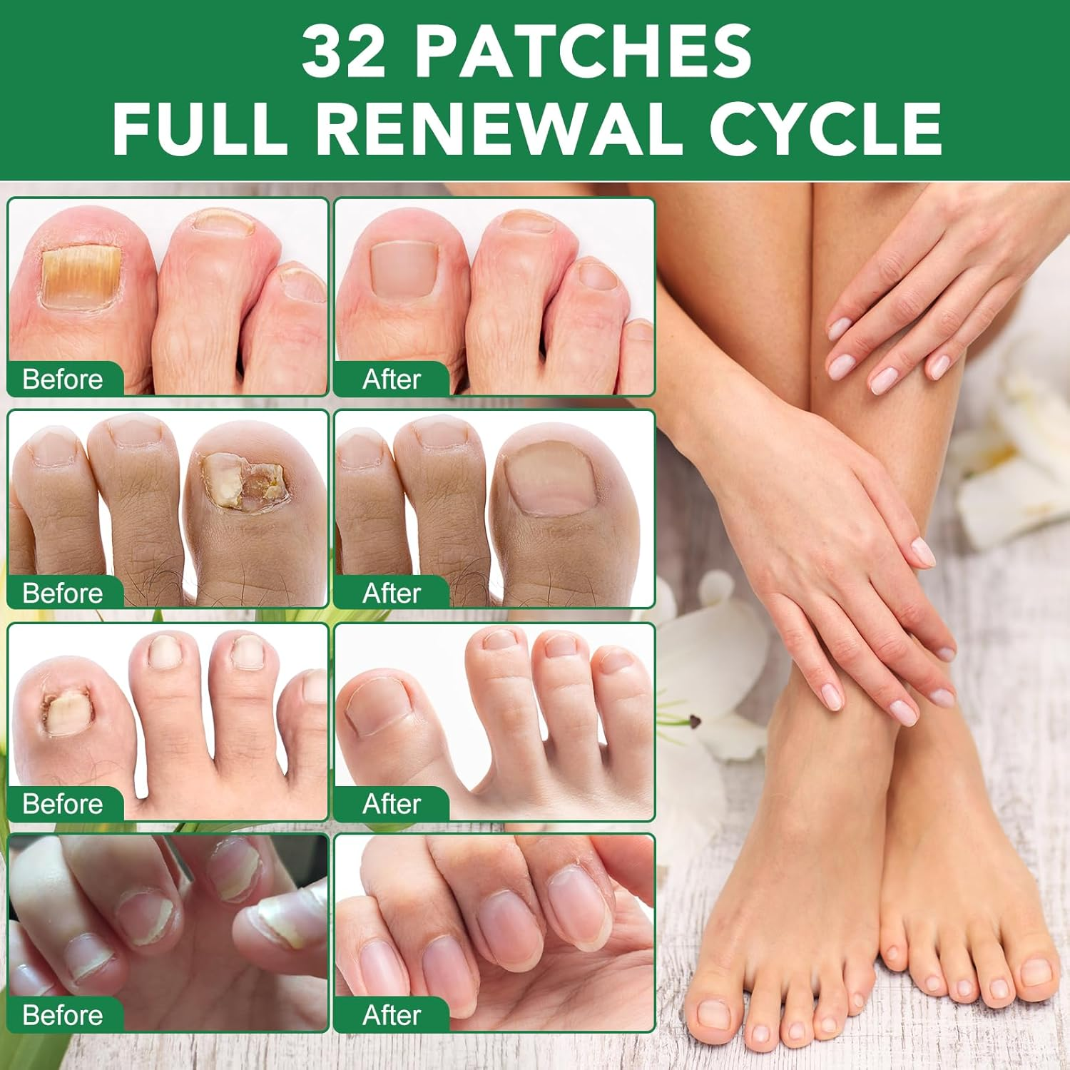 Furnrubden Fungal Nail Treatment Patches 32-Pack, 8-Hour Overnight Repair, Hypoallergenic Adhesive for Thick and Discoloured Nails