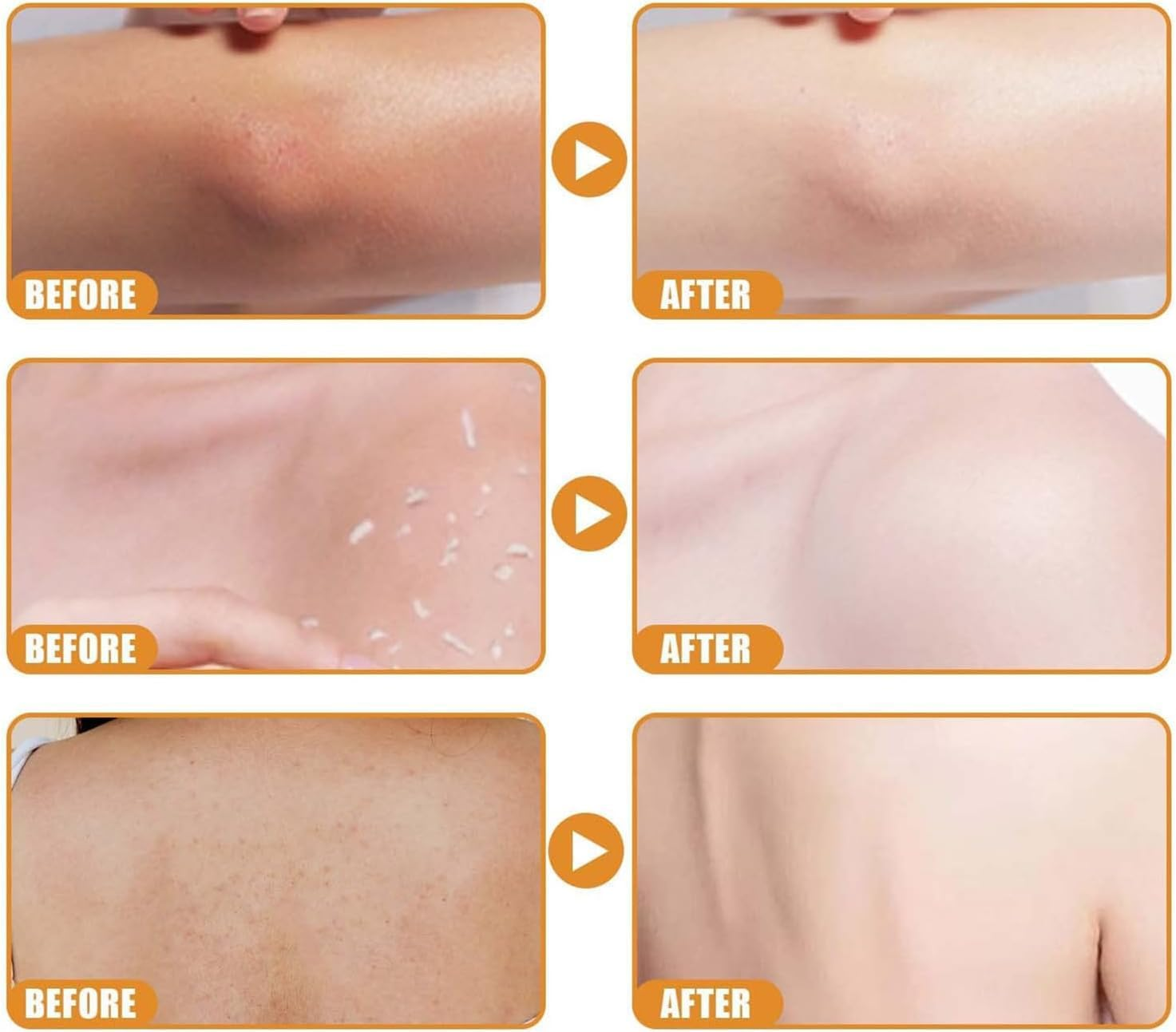 Orange Enzymes Exfoliating Brightening Gel, Purifying Exfoliating Gel for Deeply Cleansing, Facial Scrub with Vitamin C Smooth and Brightening Skin, Moisturizing and Nourishing for Dry Skin (1Pcs) image number 4