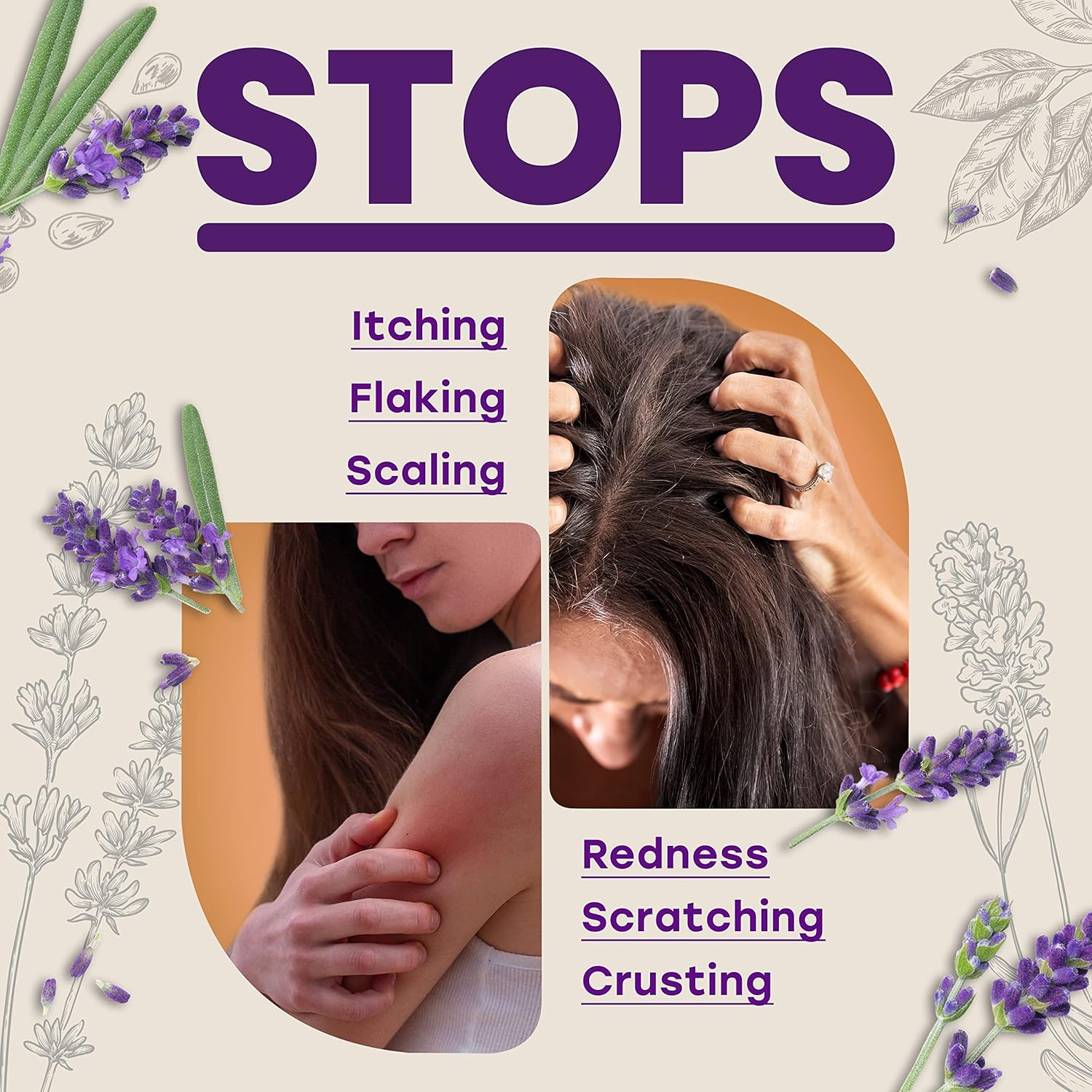 Three (3) Bars of Candida Freedom Probiotic Lavender Soap 120Ml - 3 Bars image number 2