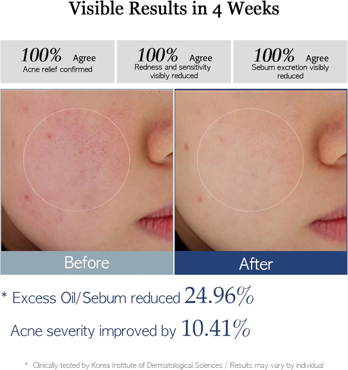 Re.Spn PHA Succinic Acid Calming Toner Pads &ndash; Daily Exfoliating, Hydrating and Soothing with CICA, Caffeine, Non-Comedogenic, Vegan, Glass Skin, K-Beauty (70 Count) image number 6