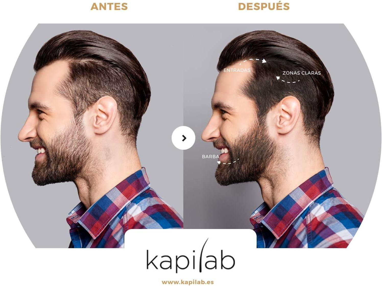 Kapilab Scalp Mask - 4G - Medium Brown image number 6