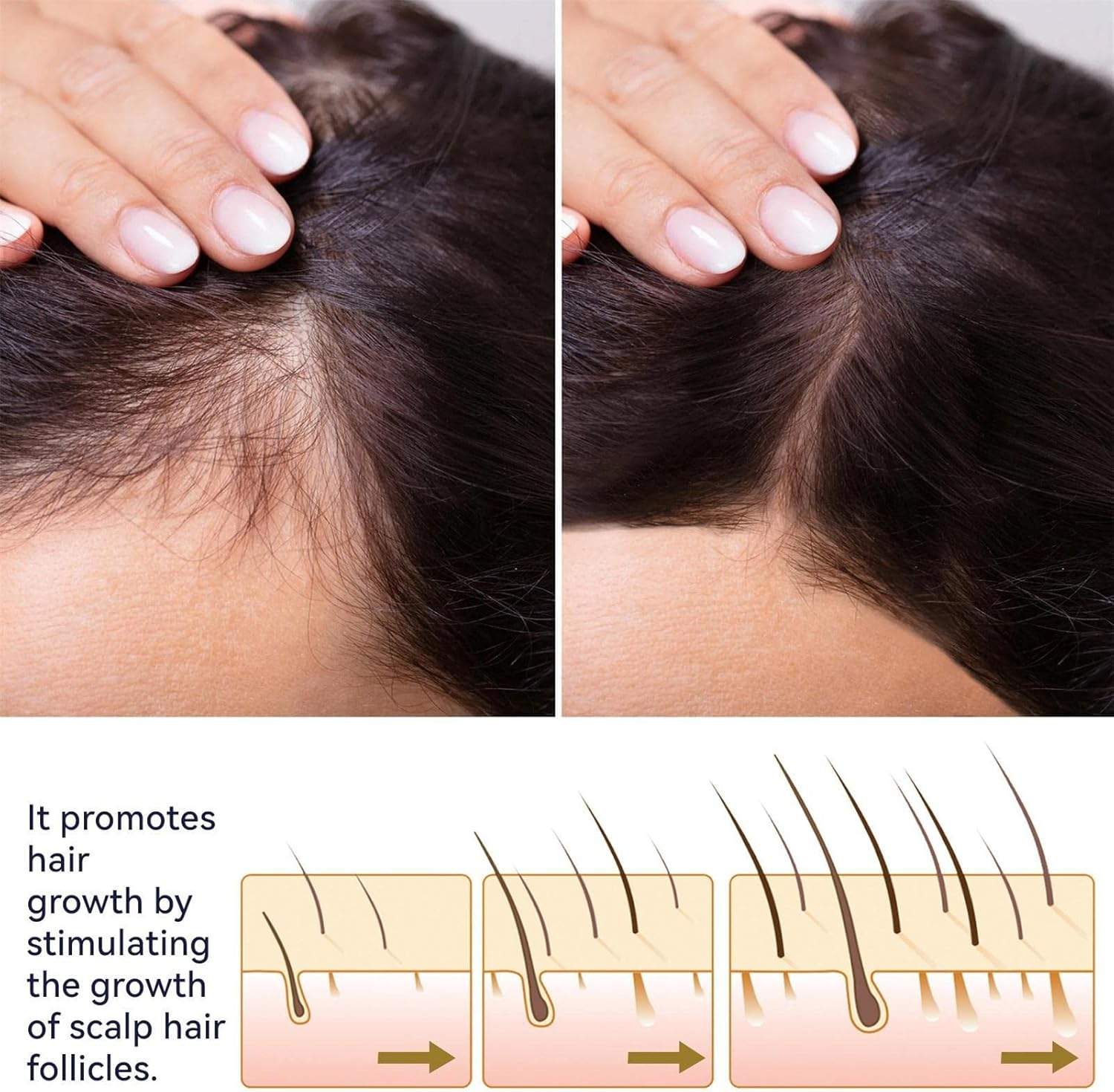 Hair Conditioner Spray,2.11Oz Hair Booster Spray | Plant Extracts Hair Regrowth Extended Nozzle Sprayer for Repairs Damaged Hair Pisole image number 6