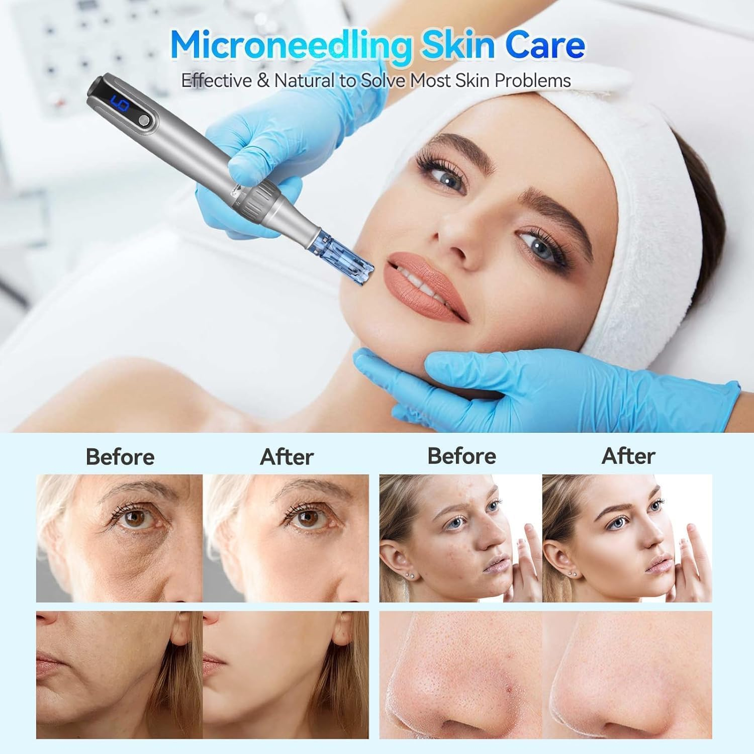 Wesileyern 20Pcs 12PIN Replacement Cartridges Needles, Dermapen Microneedling Needles, Professional Dermapen M8S/A9/ A11 Wireless Derma Roller Pen Needles, for Dermapen M8S/A9/ A11 image number 4