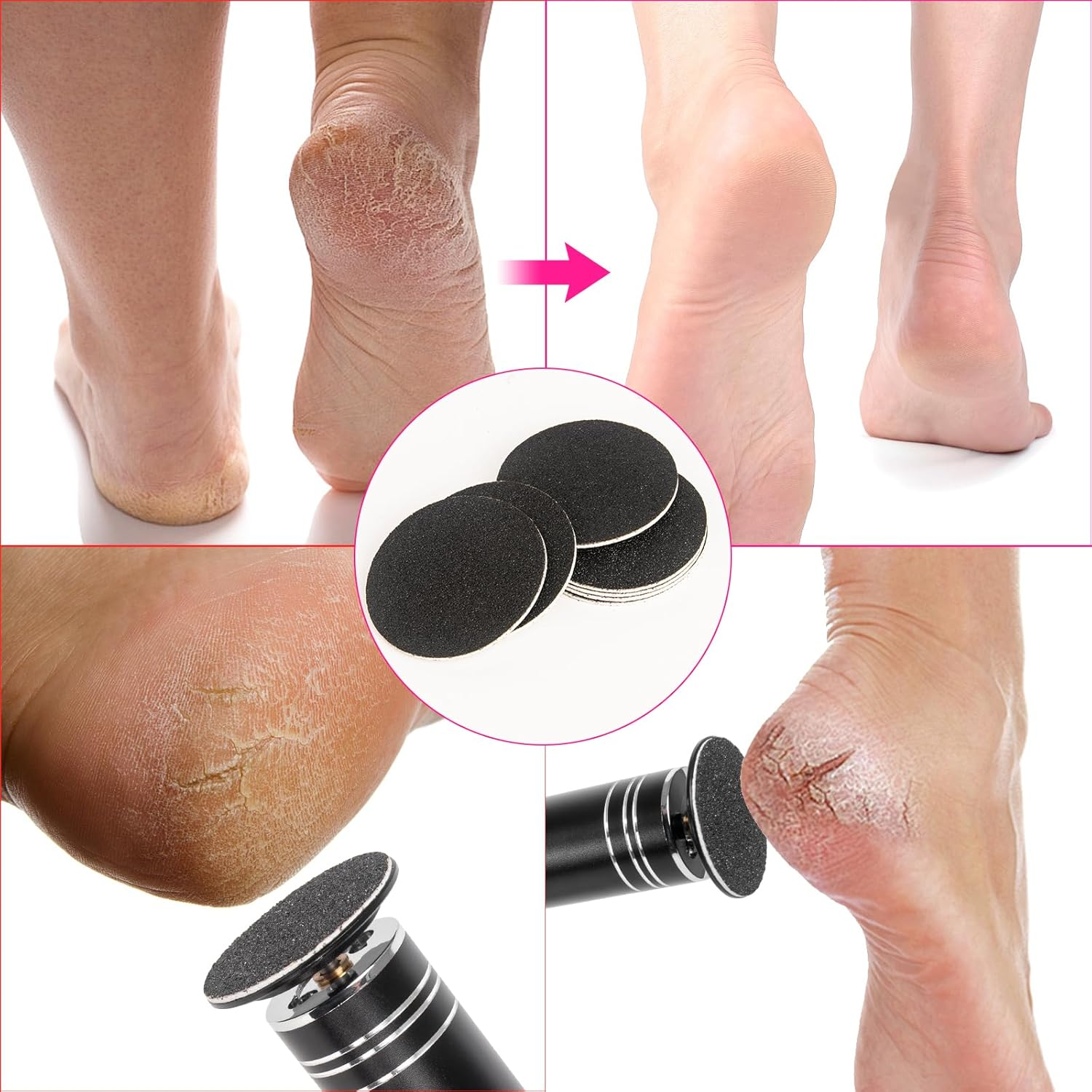 Krofaue 60 PCS Replaceable Sandpaper Discs - 80 & 100 Grit Pad Refills for Electric Foot File Callus Remover - Dead Skin and Calluses Removal image number 5