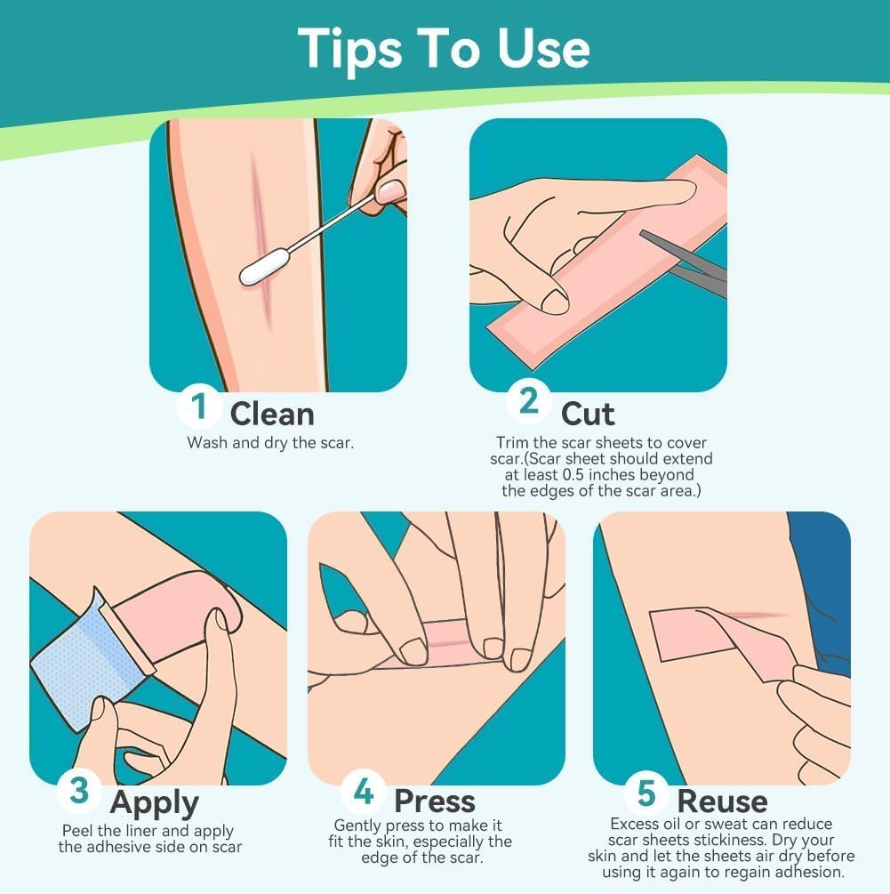 Dimora Medical Grade Silicone Scar Sheets - Ultra Soft Silicone Scar Tape (4Cmx3M), Waterproof Scar Treatment for Surgical Scars, C Section, Tummy Tuck, Keloid Treatment