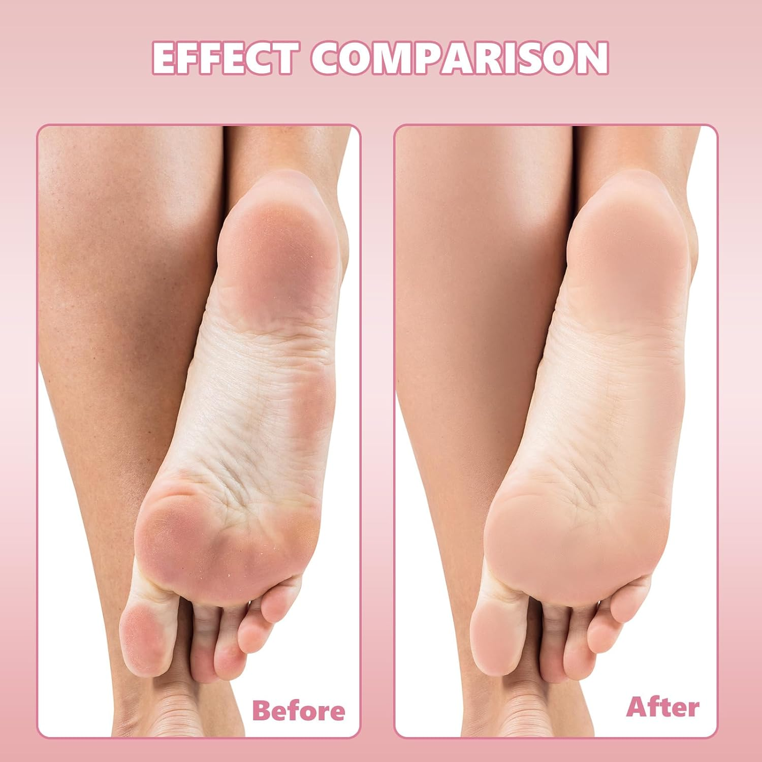 Flutesan 80 Pcs Stainless Steel Foot File Refills 180 Grit Replacement Pads Coarse Fine Pedicure File Refills Double Side Reusable Foot Rasp Pad with Removable Glue image number 6