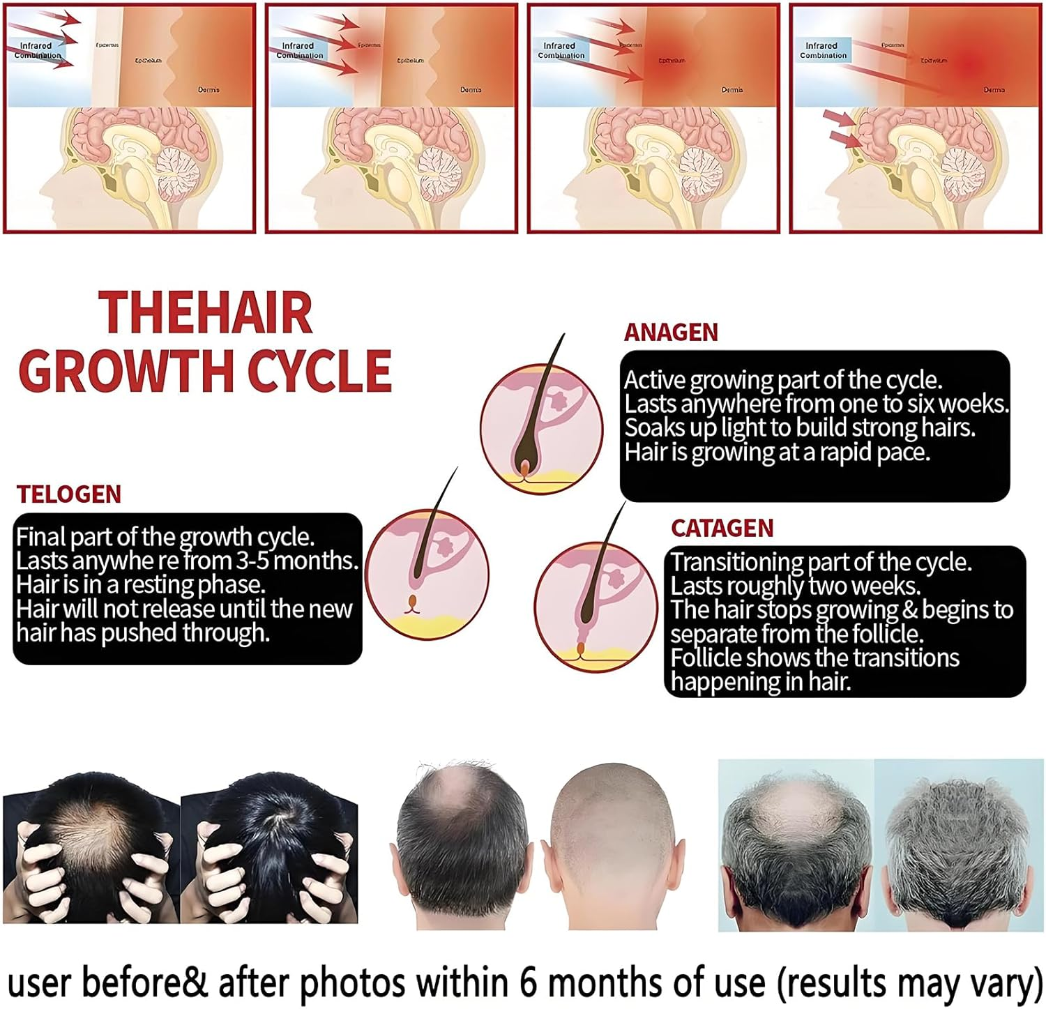 Anberyoo LLLT Cap for Hair, Red Light Therapy Hair Cap, 630Nm 650Nm Red and 470Nm Blue Light Irradiation, Rechargeable Portable Cordless Prevent Hair Loss Cap for Women Men Hair Care/Maintenance image number 5