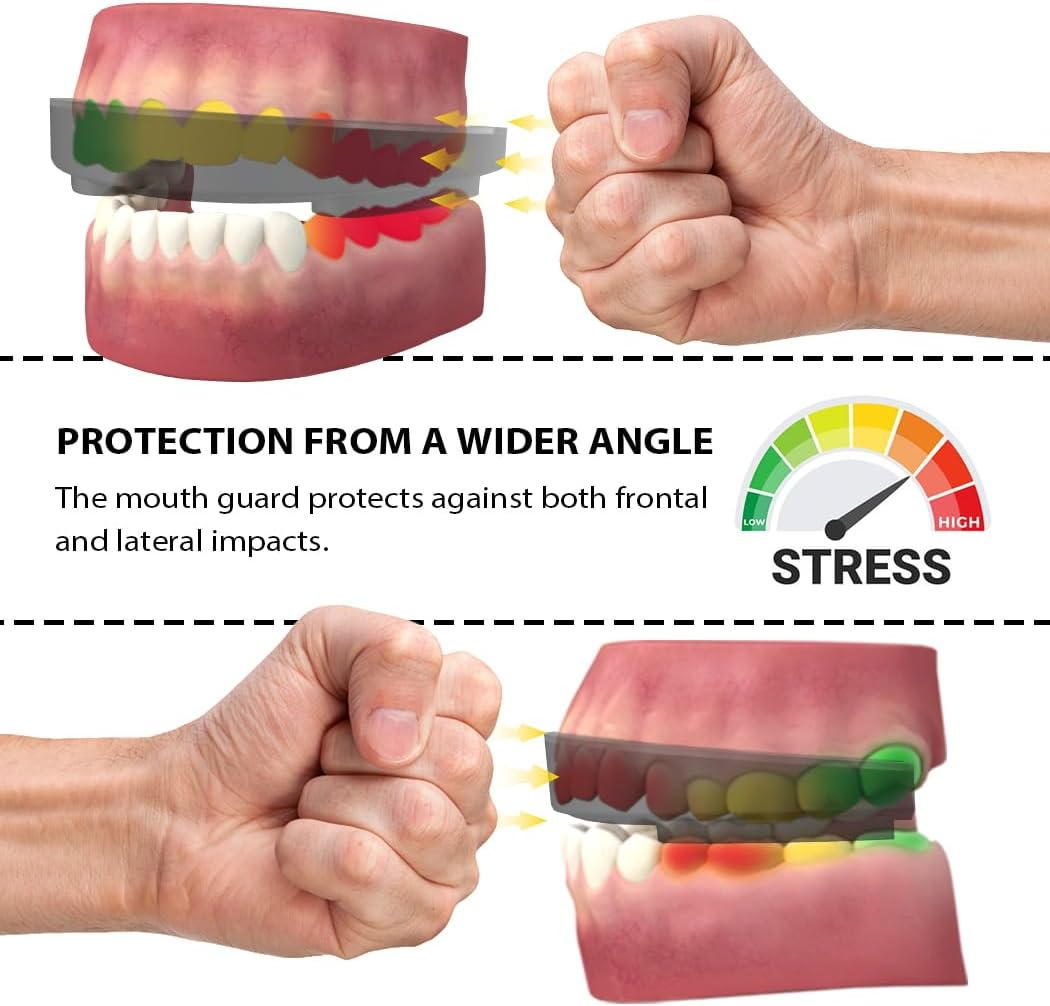 HUGEOAKS SG-III Sport Mouth Guard, Multi-Layer Composite Material, Maximum Angular Protection, Extreme Strength, for Football, Boxing, Basketball, MMA, Hockey and Other Sports (White-Yellow-Black) - Black-Green-Black image number 5