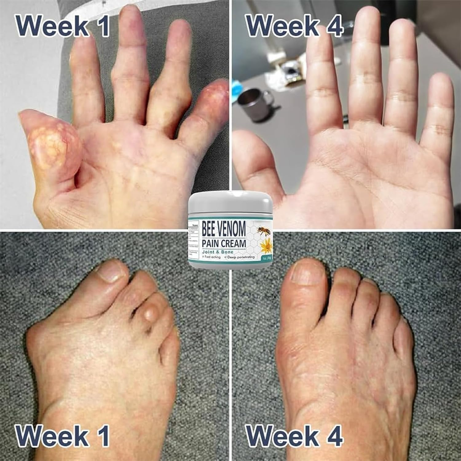 3Pcs Bee Venom Pain and Bone Healing Cream,Advanced Bee Venom Gel Joint and Bone Therapy,New Zealand Bee Venom Joint and Bone Therapy Cream