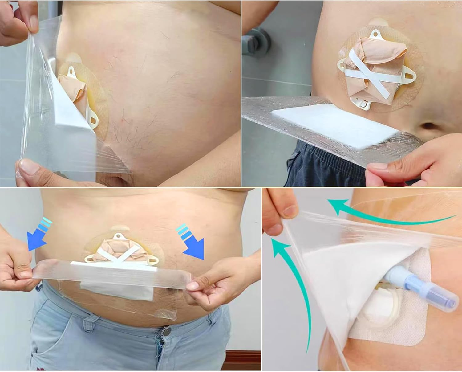 Waterproof Wound Bandage Patches with Absorbent Gauze Pads, Large Wound Dressings Pads，Post Surgical Shower Wound Cover Protector,6Pcs image number 1