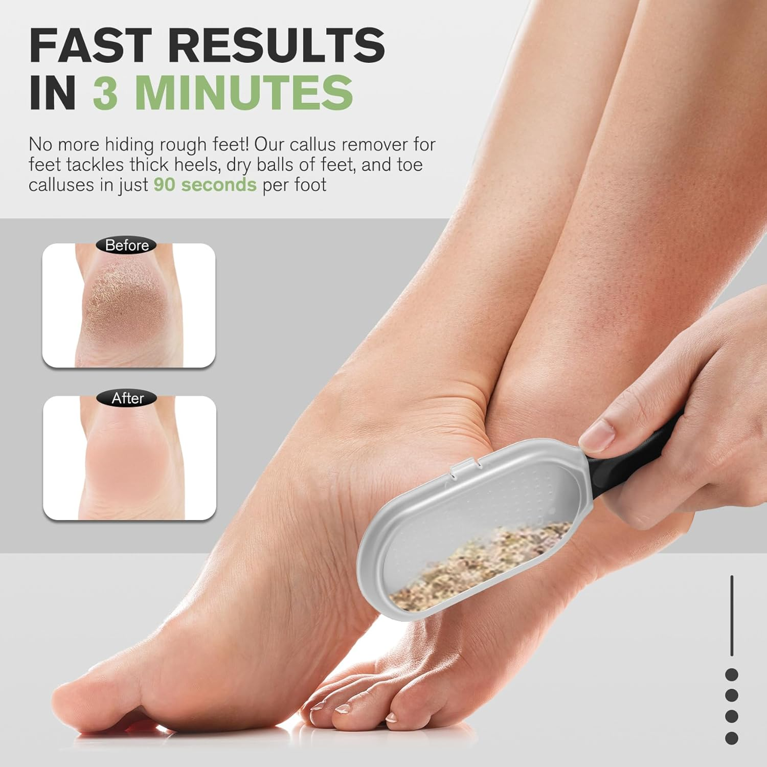 FERYES Foot File Callus Remover with Dead Skin Catcher &ndash; the Genius Foot Scrubber for Mess-Free Pedicures, Heel Scraper for Cracked Heel Treatment, Wet & Dry Use Feet Rasp - Black image number 5