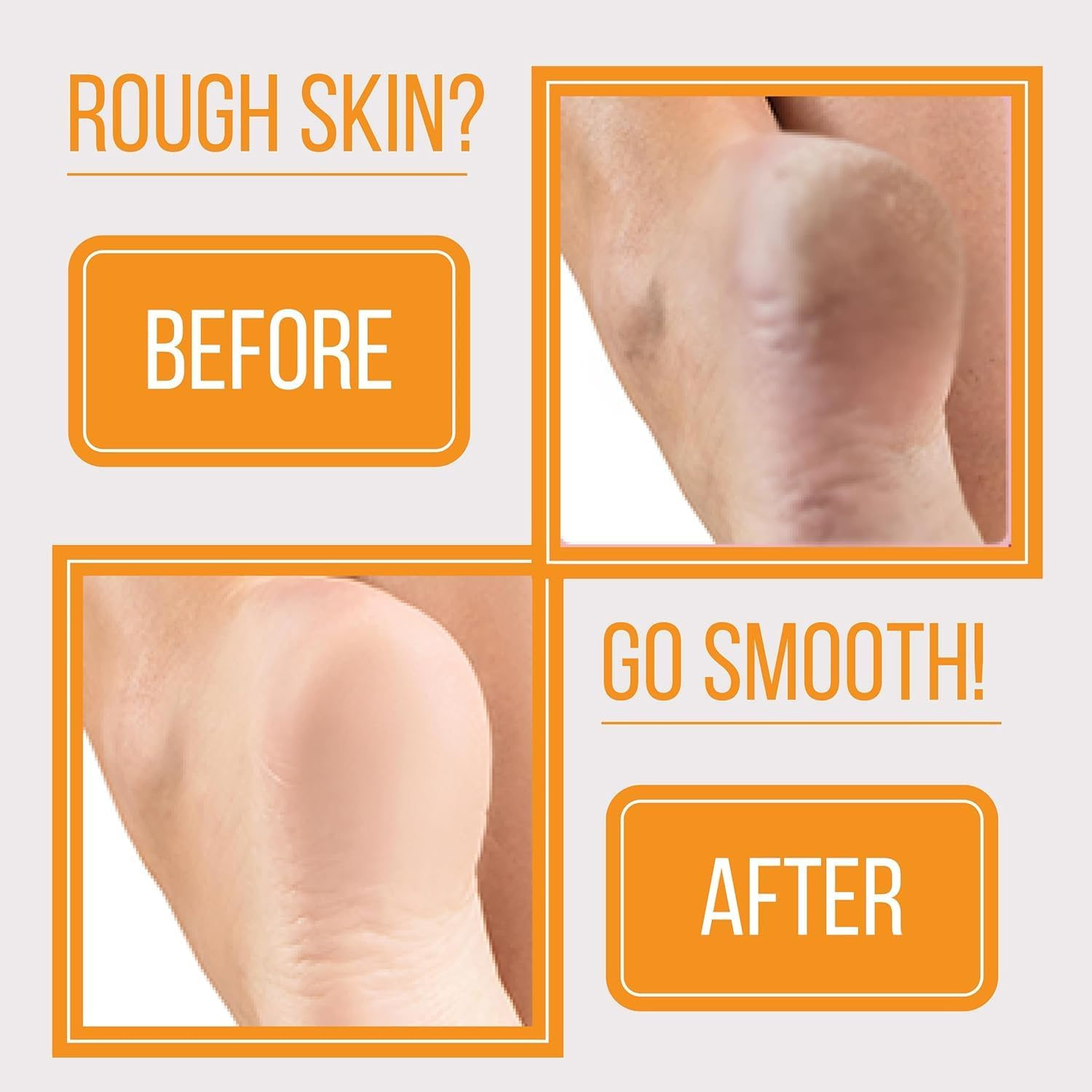 Foot Rasp Foot File and Callus Remover - Pedicure Tool for Removing Dead Skin, Feet Hard Skin Remover, Foot Scraper, Can Be Used on Both Wet and Dry Feet (Black, One Size) image number 3