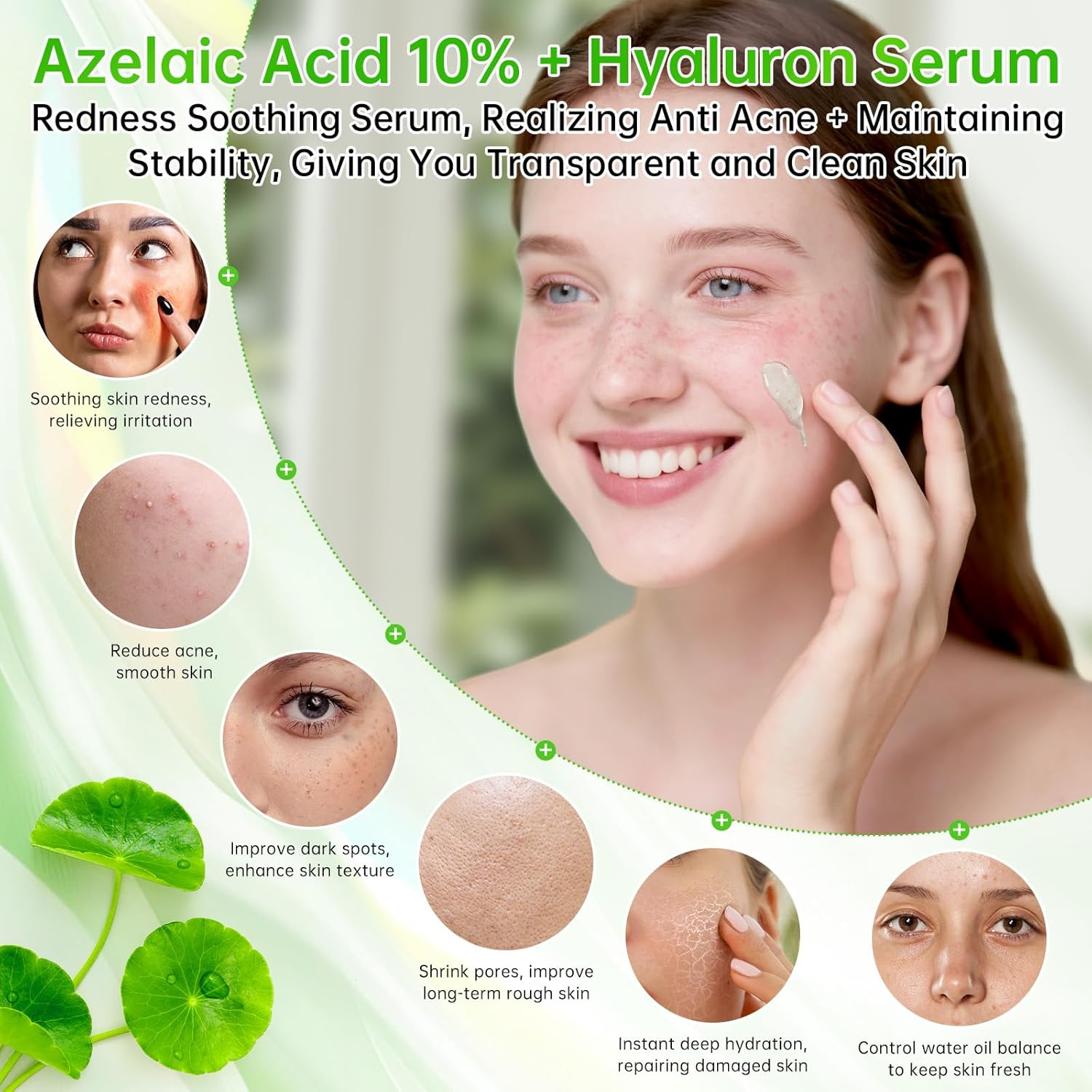 Azelaic Acid Serum for Face, Azelaic Acid 10 + Hyaluron Serum for Sensitive Skin, 30Ml Hyaluronic Acid Serum with Niacinamide for Acne & Spot Care, Redness Relief. image number 6