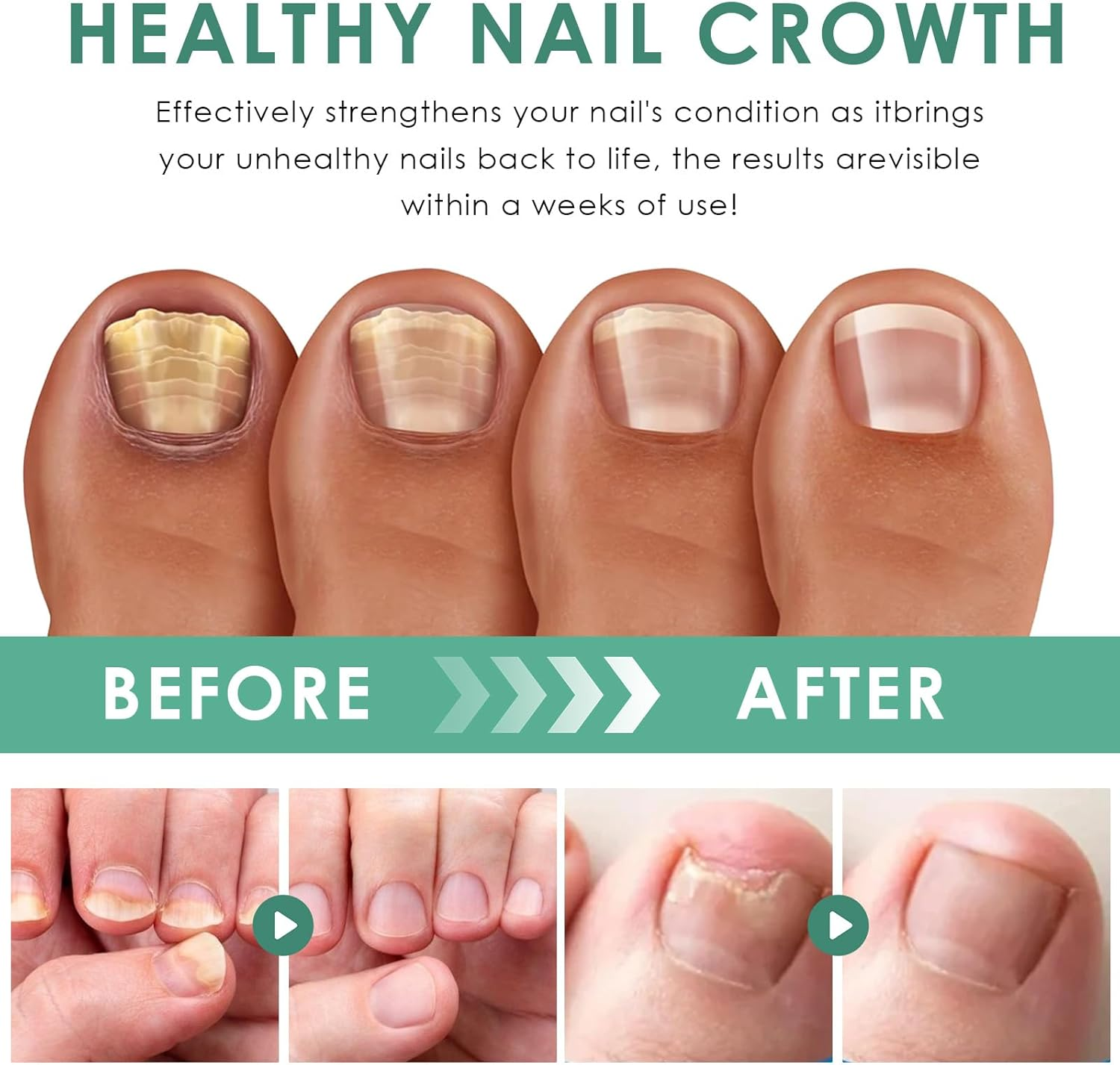 Pack of 3 Nail Care Pens, Nail Care Moisturising, Nail Care Pen, for Fingers and Toenails