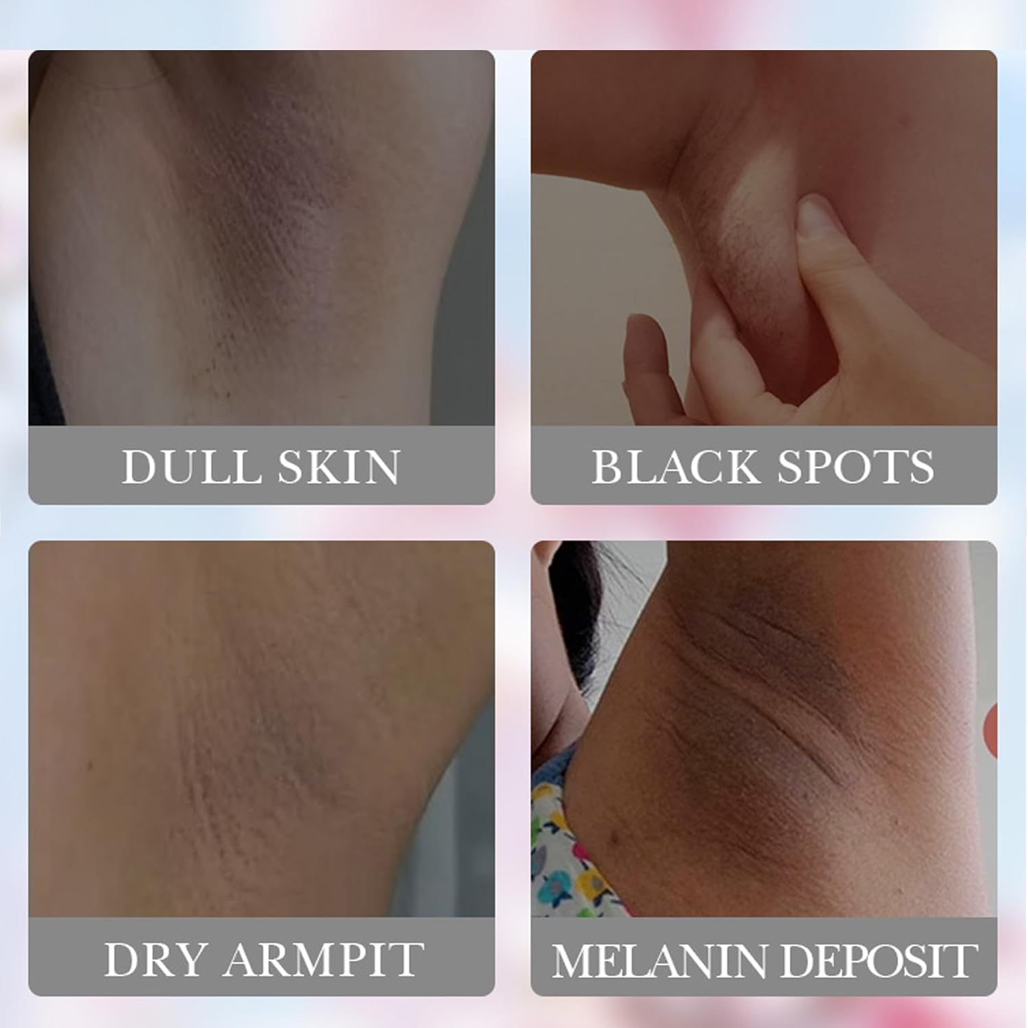 Skin Whitening Cream Gentle Formula Cherry Blossom for Dry Arm Black Spots Body Legs Underarms Bikini Area Skin Whitening Bleach with Smoothness Moisturizng 40G 1.4OZ image number 6