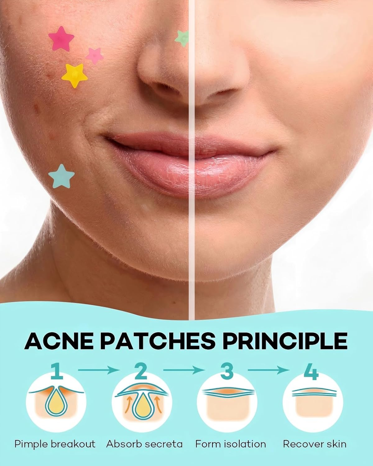 Pimple Patches for Face (400Pcs /10 Sheet), Pink & Blue & Yellow & Green & Rose Acne Patches, Hydrocolloid Patch Acne Dots, Zit Patche for Face Body Skin Clear Spot Treatment Pimple Stickers - Transparent 360Pcs /10 Sheets image number 7