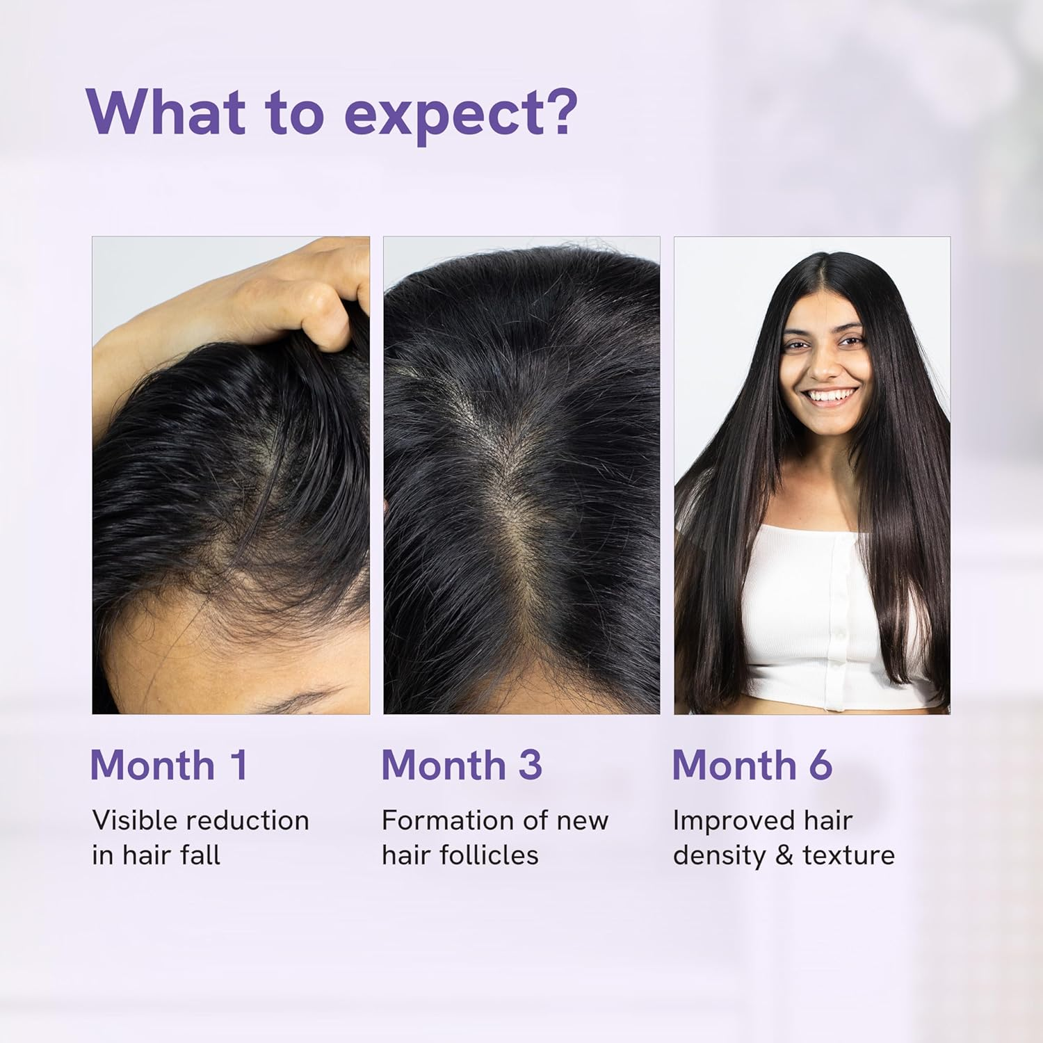 Bodywise Hair Fall Control Serum | 21% Plant Based Actives | 3% Redensyl, 3% Procapil, 2% Baicapil | Reduces Hair Fall | No Side Effects | 60Ml