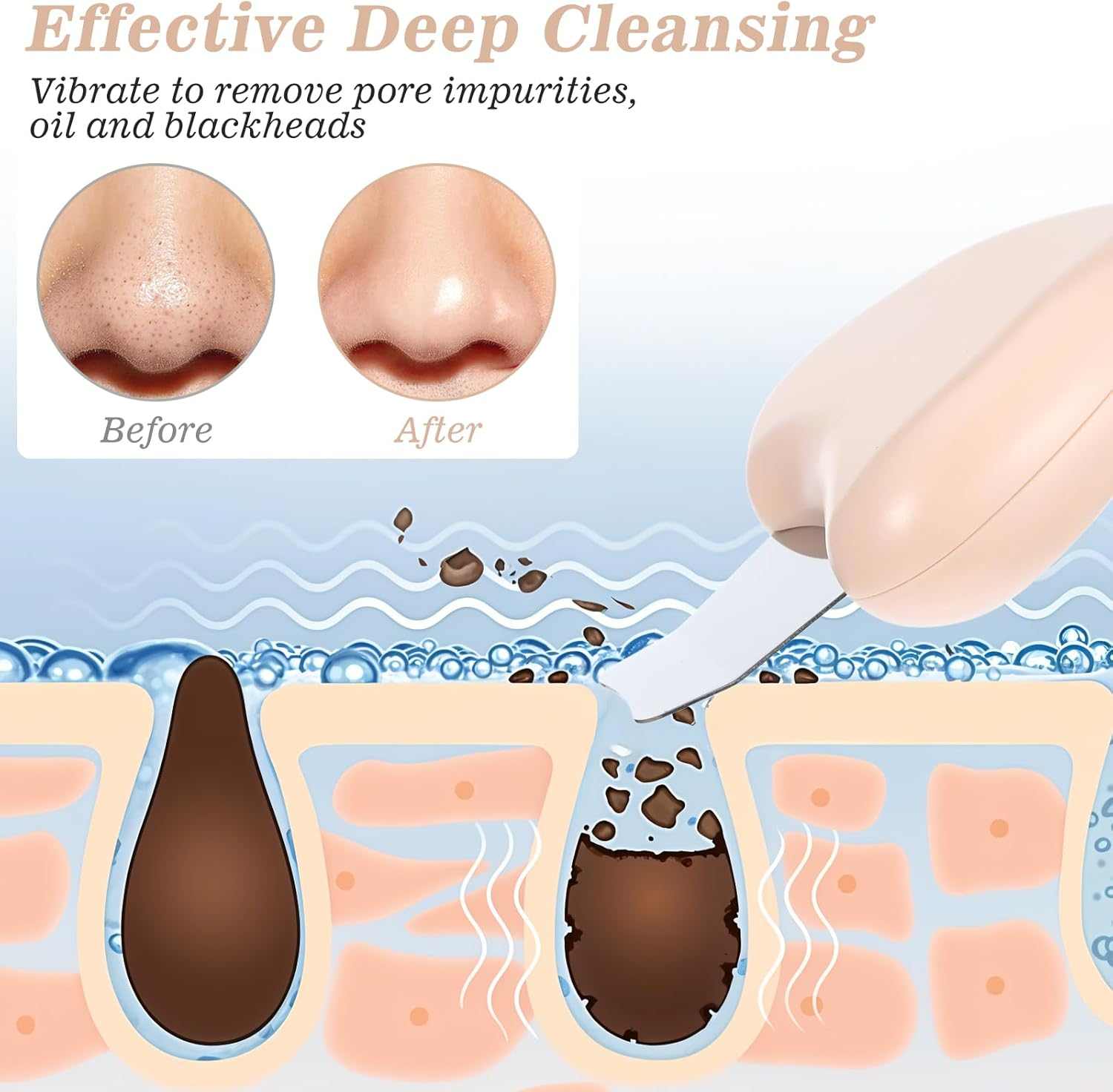 Thinp Face Spatula Blackhead Scraper Pimple Scraper Blackhead Remover Scraper Metal Extractor Beige Plastic Blackhead Shovel for Women Men Blackhead Removing image number 4