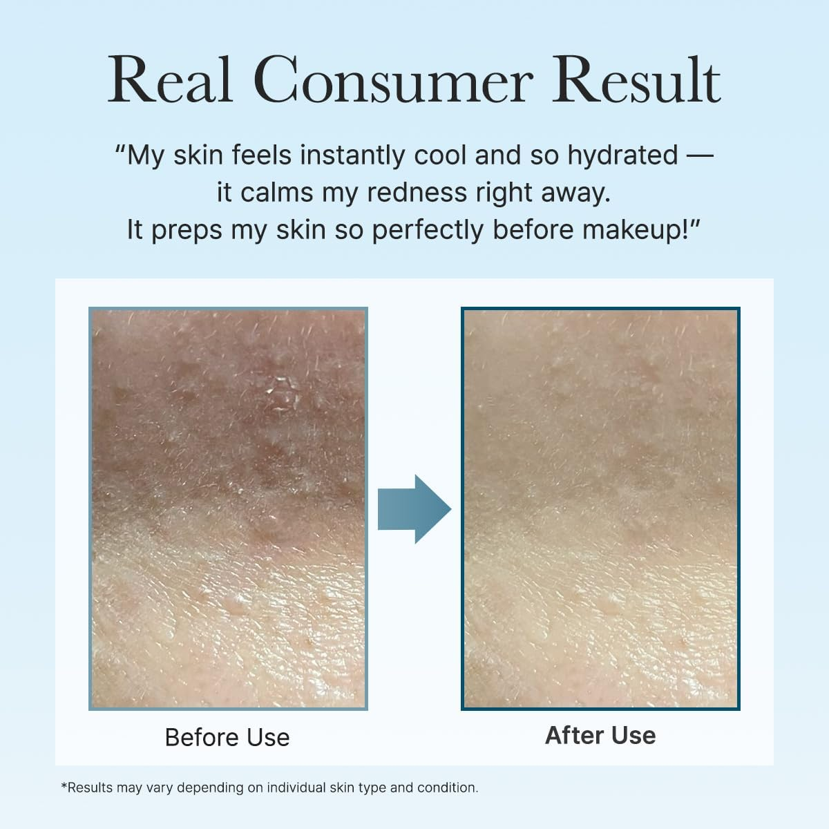 Arencia PDRN Hyaluronic Deep Hydration Toner Pads, 90 Count, 6.76 Fl. Oz, with 10 Types of Hyaluronic Acid for All Skin Types image number 3