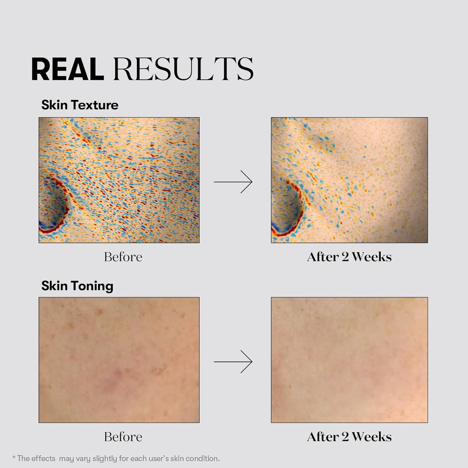 VT COSMETICS TX Toning Face Cream, Hydrating Moisturizer with Tranexamic Acid, Niacinamide & Glutathione, Skin&rsquo;S Barrier Repair, Moisturizing, Dark Spots, Sensitive Skin Care, Korean Skincare image number 2