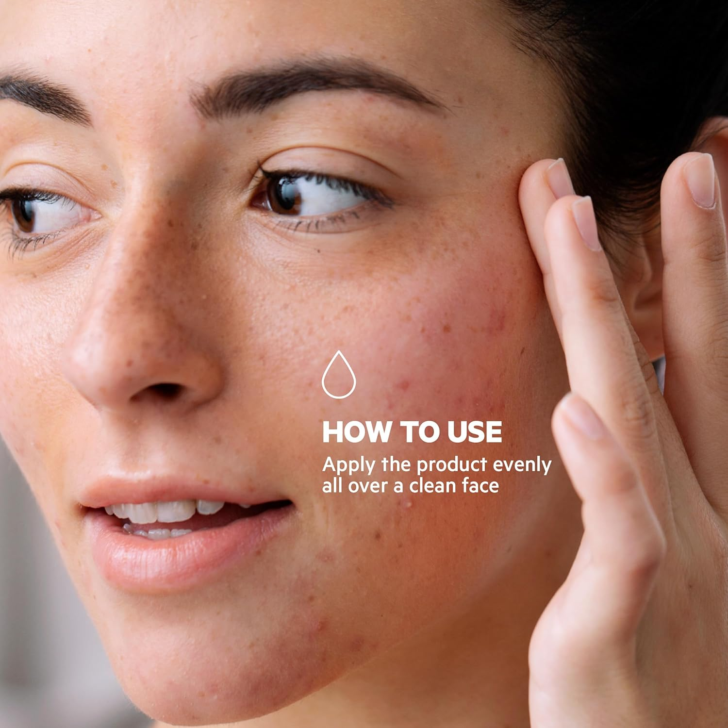 SVR SEBIACLEAR Active - Anti-Blemish Face Gel-Cream for Acne-Prone, Oily, Combination Skin, Intensive Corrector for Whiteheads, Blackheads and Redness, 40Ml (Tinted) image number 2