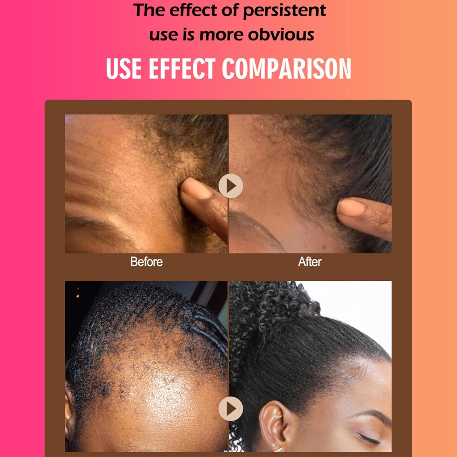 1/3 Oil for Hair Growth - 40Ml Nourishing Dry Hair Ends Oil Leave-In Repair Oil Hair Care Oil Hair Root Smoothing Oil for Hair Dryness, Split Ends, and Breakage