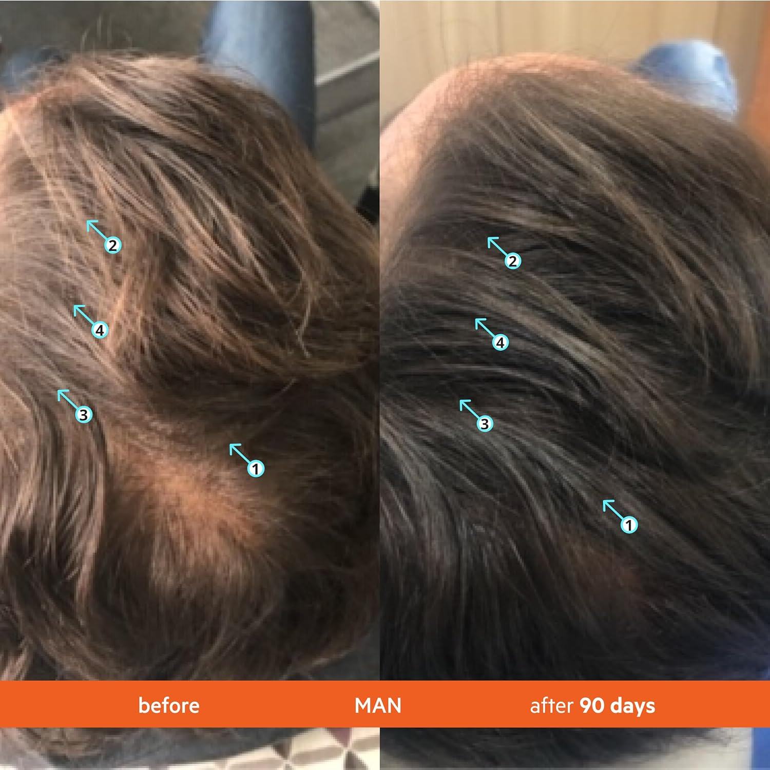 DS Labs Revita Shampoo and Conditioner &ndash; High-Performance Hair Density Kit, Volumizing, Thickening, Fuller, Sulfate & Silicone Free, for Men & Women, 925Ml, Packaging May Vary image number 5