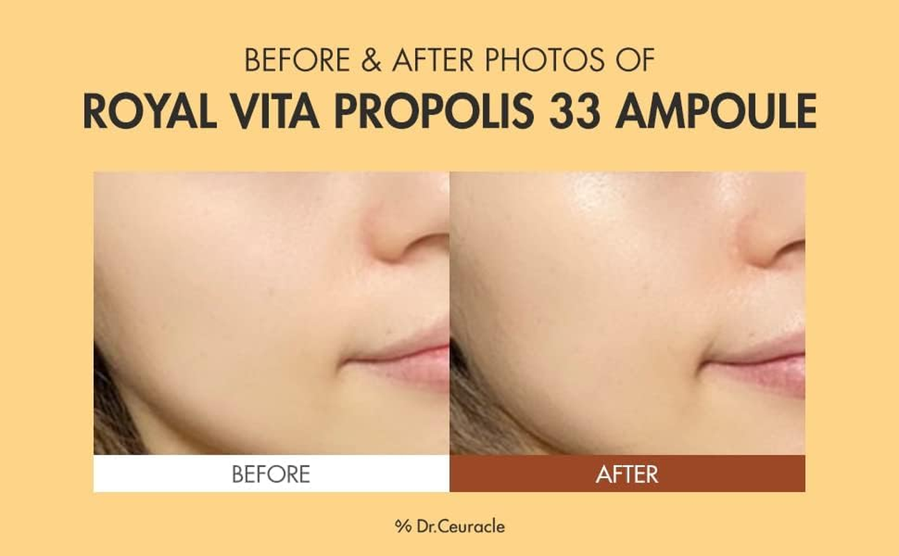 Honey Nourishing EssenceㅣRoyal Vita Propolis 33 AmpouleㅣKorean Skin Care Contains Royal Jelly Extract, PanthenolㅣEffective Vitamin Serum Strengthen the Skin Moisturizing, SoothingㅣDr.Ceuracle