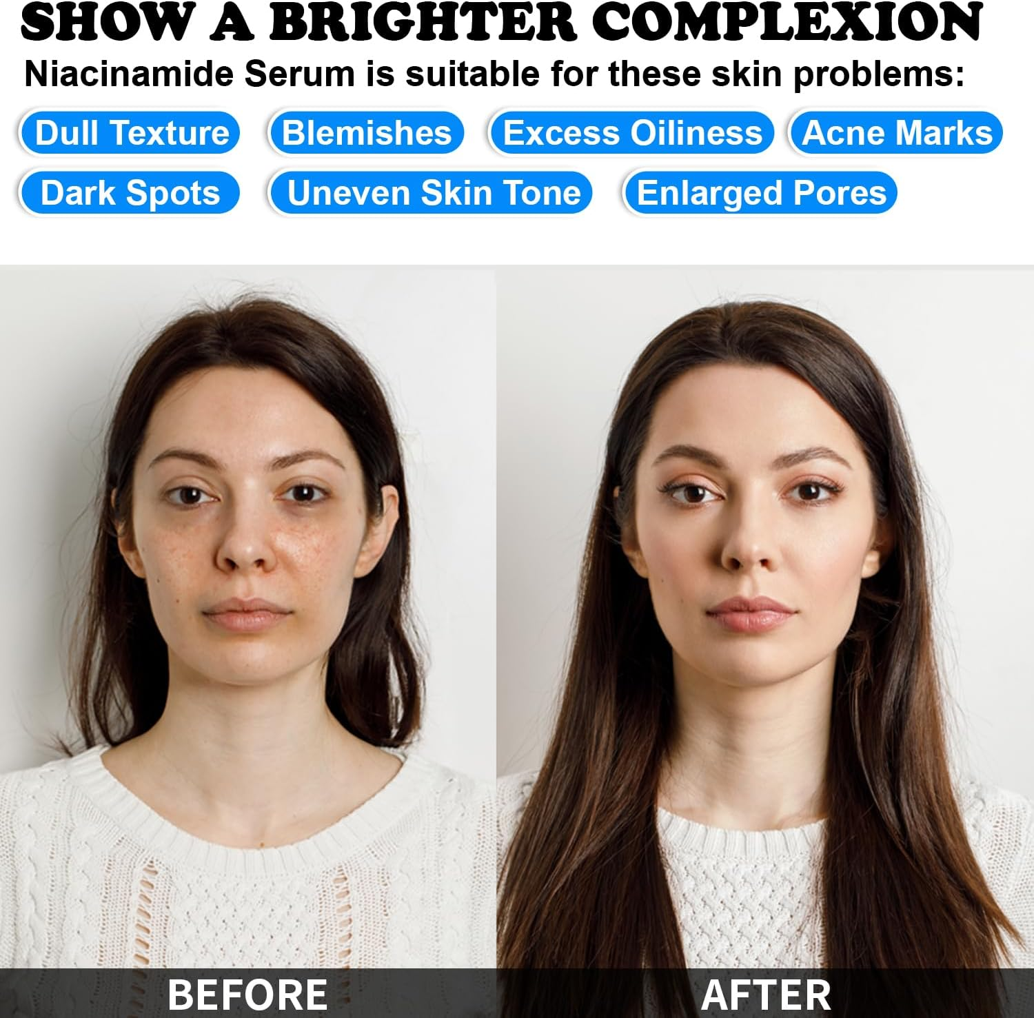 MISSEDSEN Niacinamide Serum with Zinc and Hyaluronic Acid, 30Ml, for Sensitive and Blemish-Prone Skin image number 2