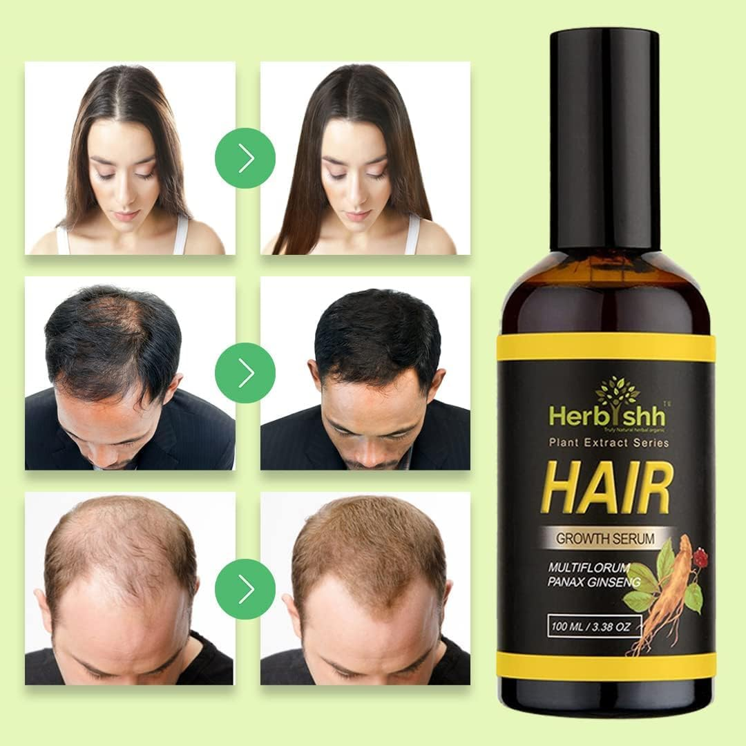 Herbishh Hair Color Shampoo (Chestnut Brown) + Hair Growth Serum | 3-In-1 Gray Hair Dye Shampoo &ndash; Ammonia-Free | Hair Serum for Fuller Hair & Healthy Scalp | Hair Care Combo &ndash; 500Ml image number 3