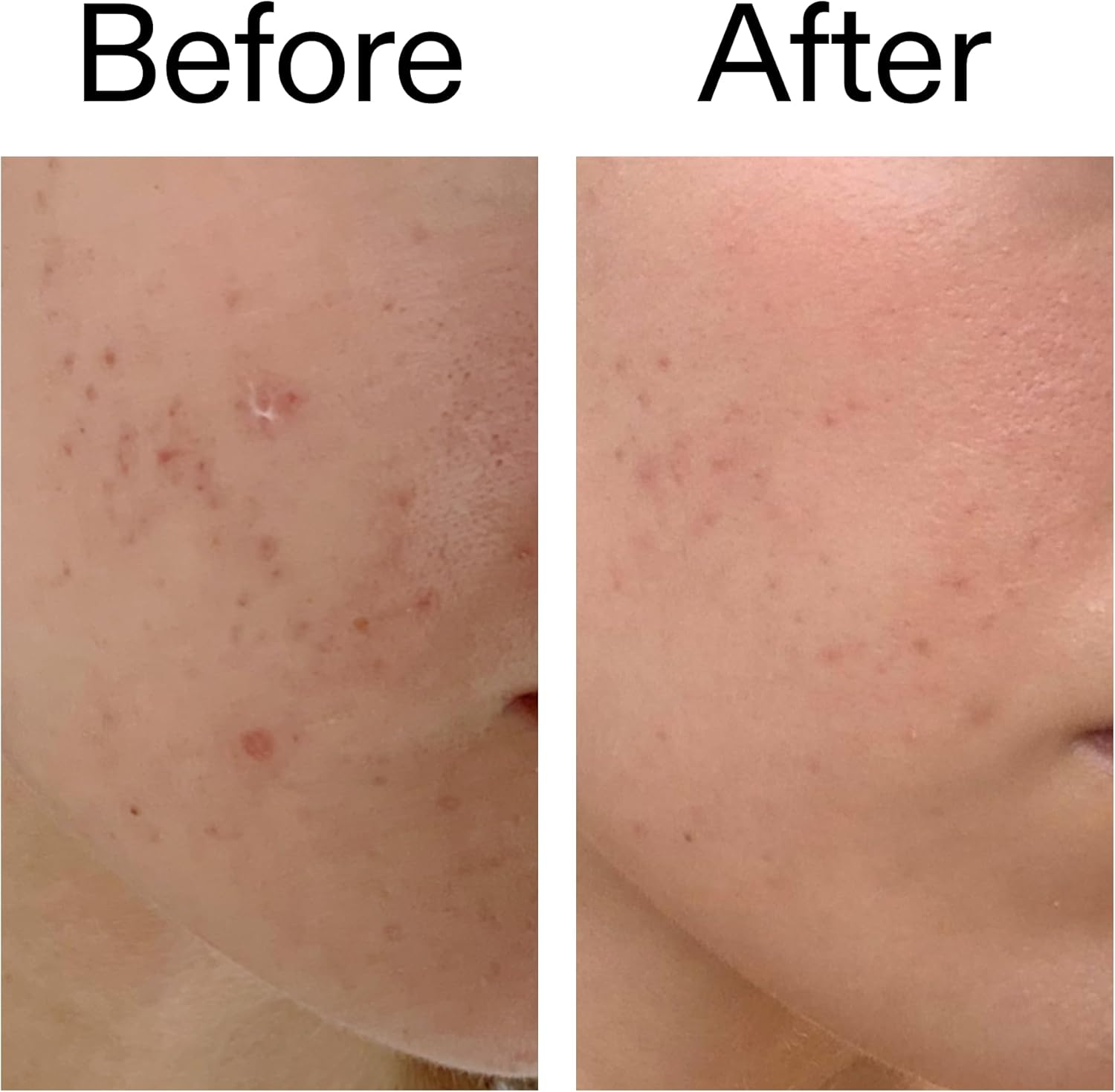 The INKEY List Mandelic Acid Treatment 15 Ml image number 3