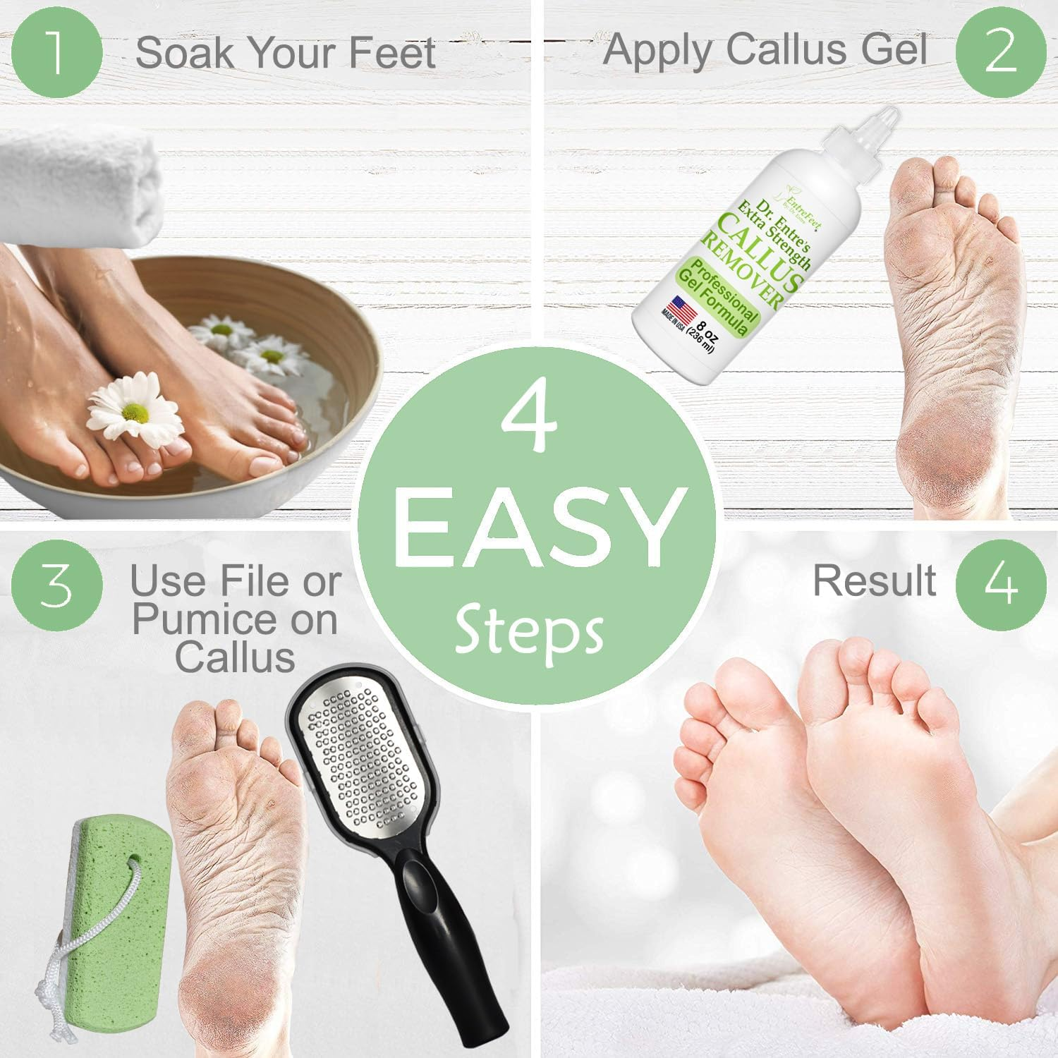 Dr. Entre'S Callus Remover Gel Kit for Feet: Foot File, Pumice Stone, 5 Glove Pairs for Gel Application, Spa Kit, Foot Care, Pedicure Tools, Scrubber, 8Oz image number 4