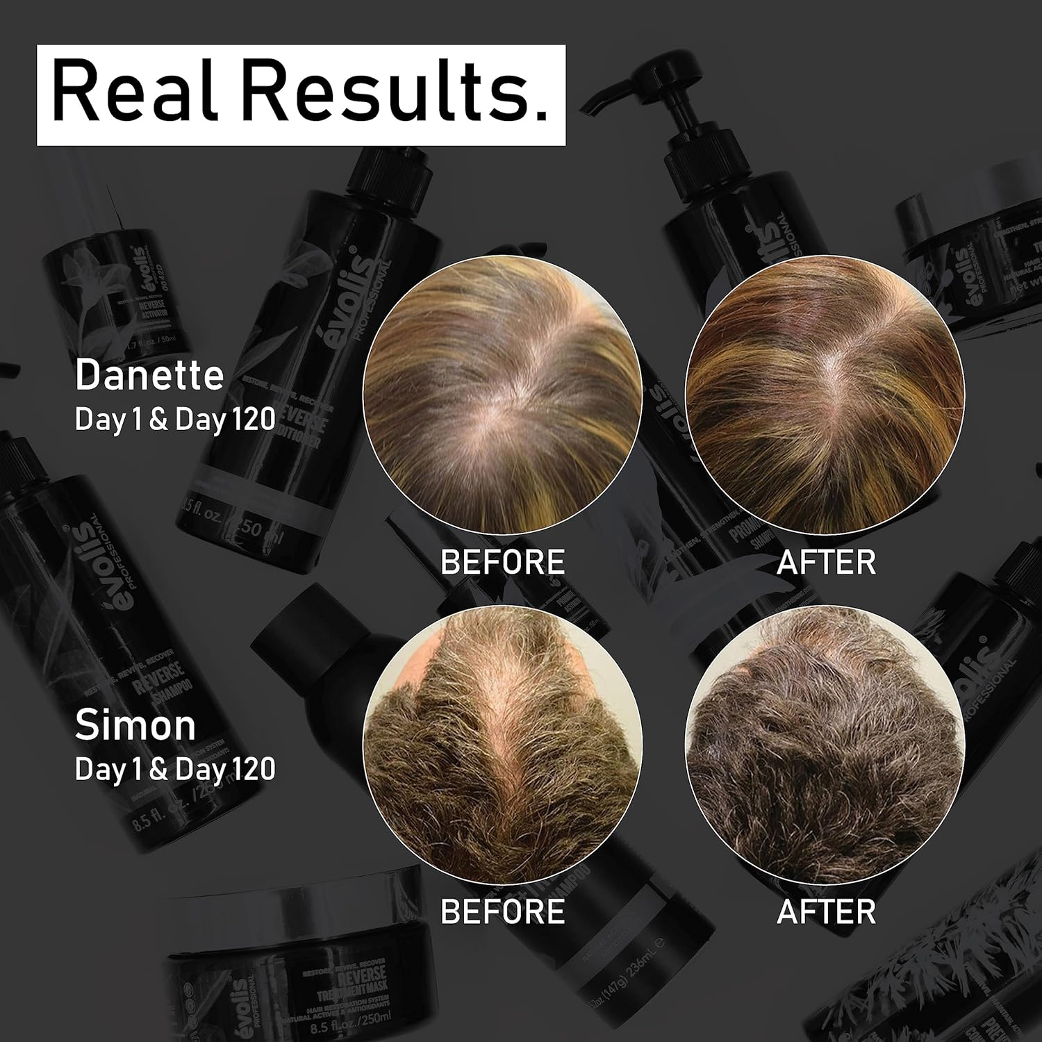 Evolis Professional Prevent Shampoo 250Ml image number 6