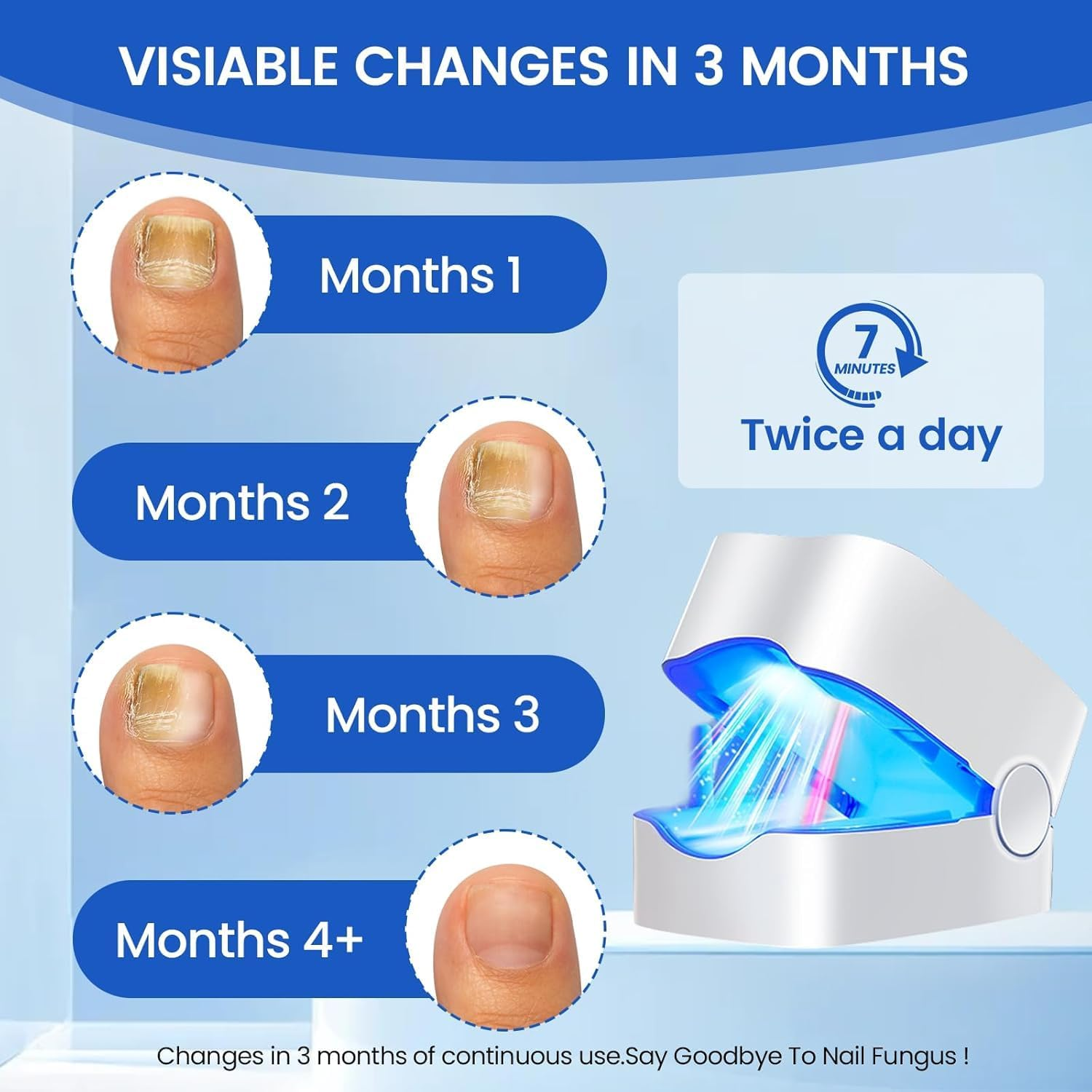 UV Light Nail Fungus Laser Device, Onychomycosis Laser Device with 470Nm Blue & 910Nm Infrared Light, Toenail Fungus Ideal for Home Treatment with LED Time Display for Home Use