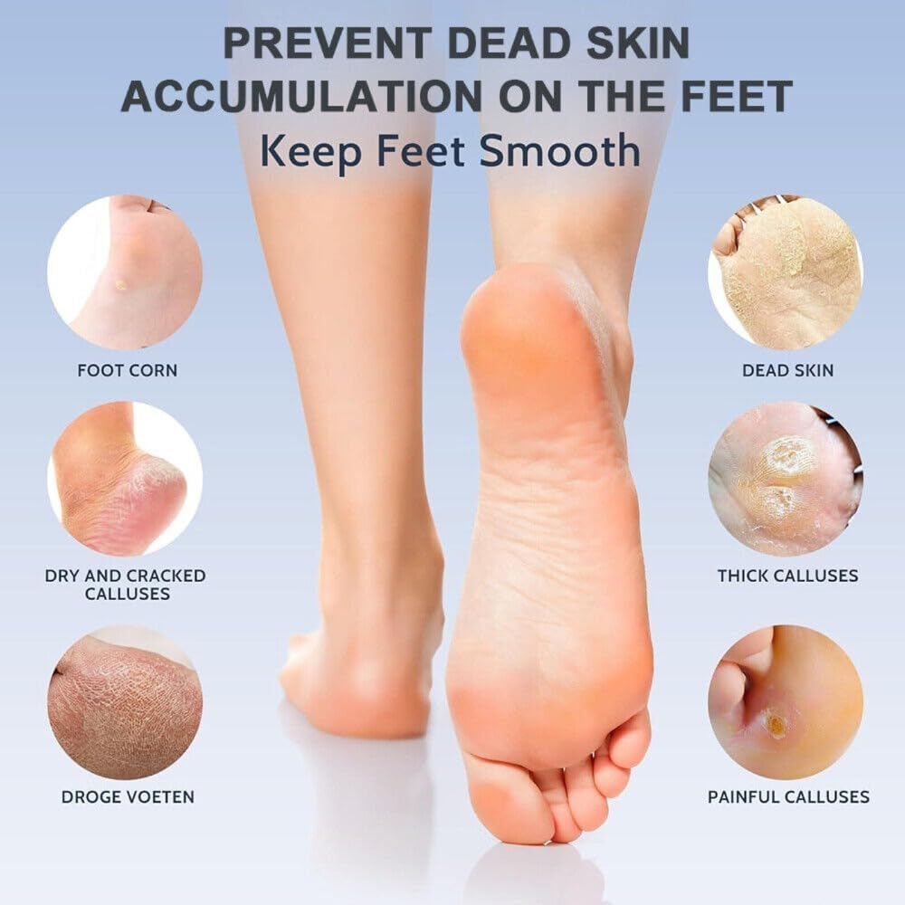 2-In-1 Electric Foot File Callus Remover 9 Adjustable Speed USB for Home & Salon image number 4